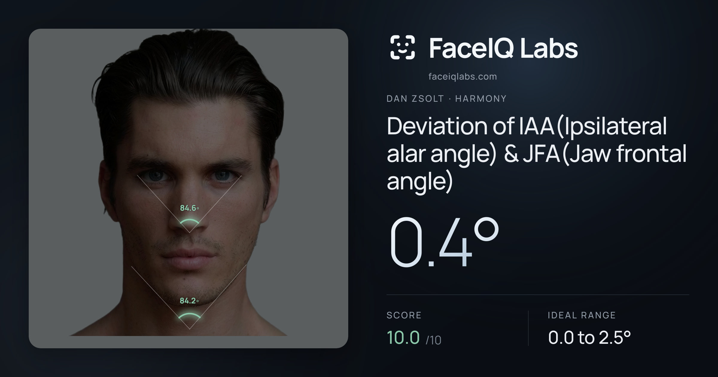 Dan Zsolt Deviation of IAA(Ipsilateral alar angle) & JFA(Jaw frontal angle): 0.4°, drawn on the photo