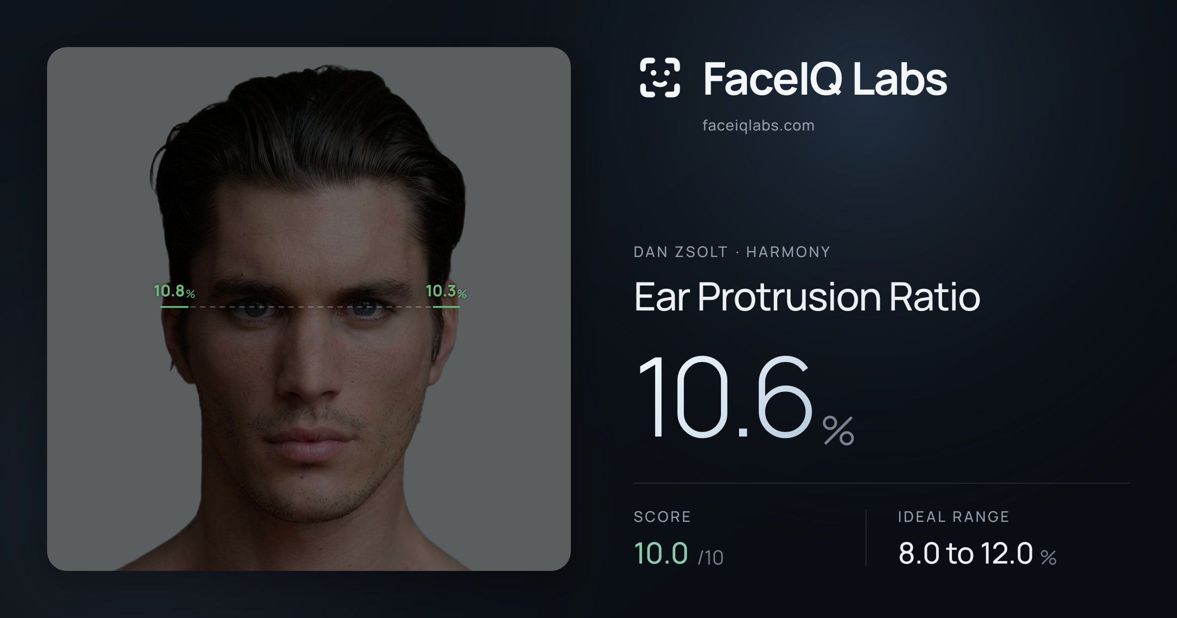 Dan Zsolt Ear Protrusion Ratio: 10.6%, drawn on the photo