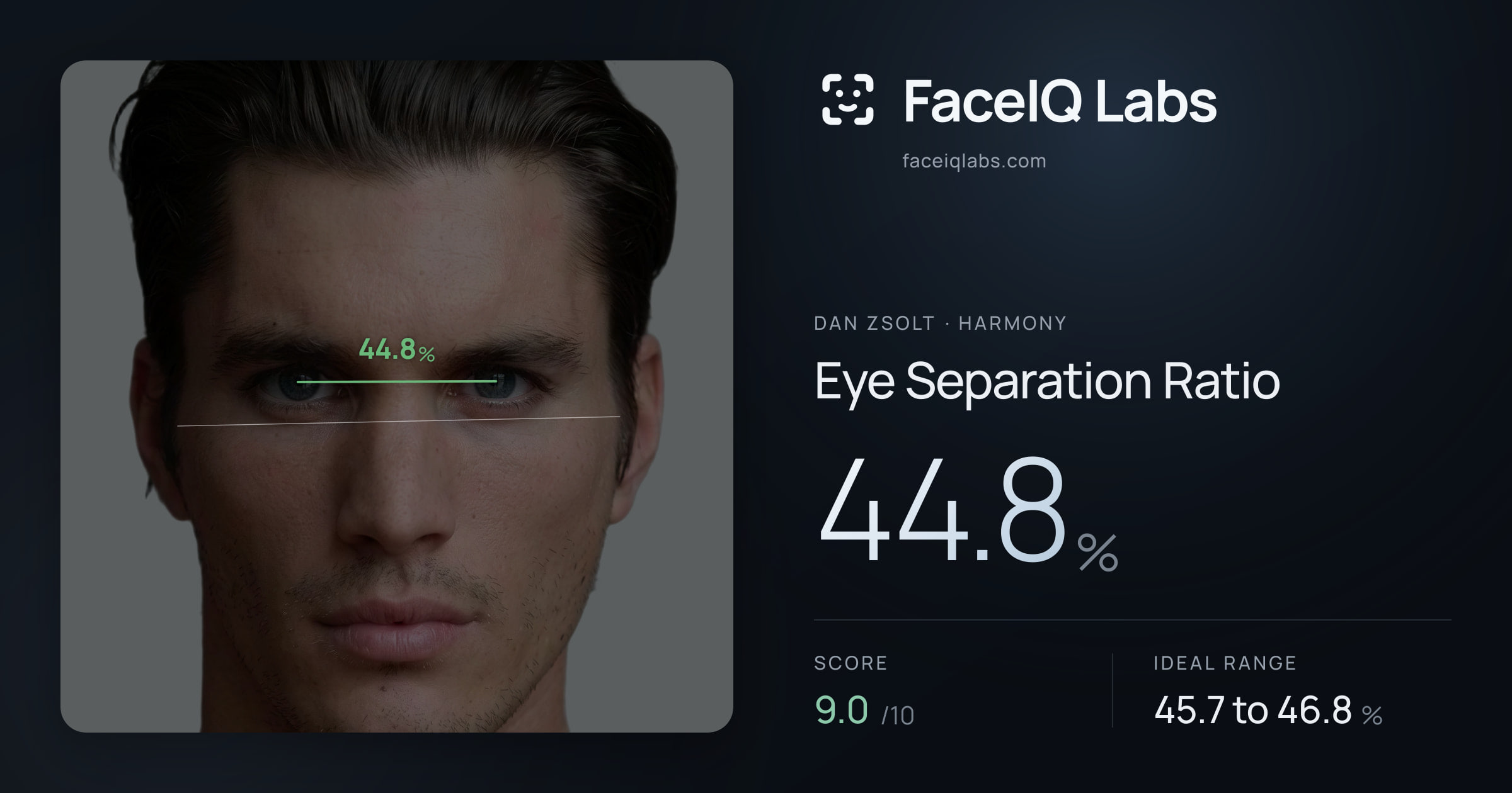 Dan Zsolt Eye Separation Ratio: 44.8%, drawn on the photo