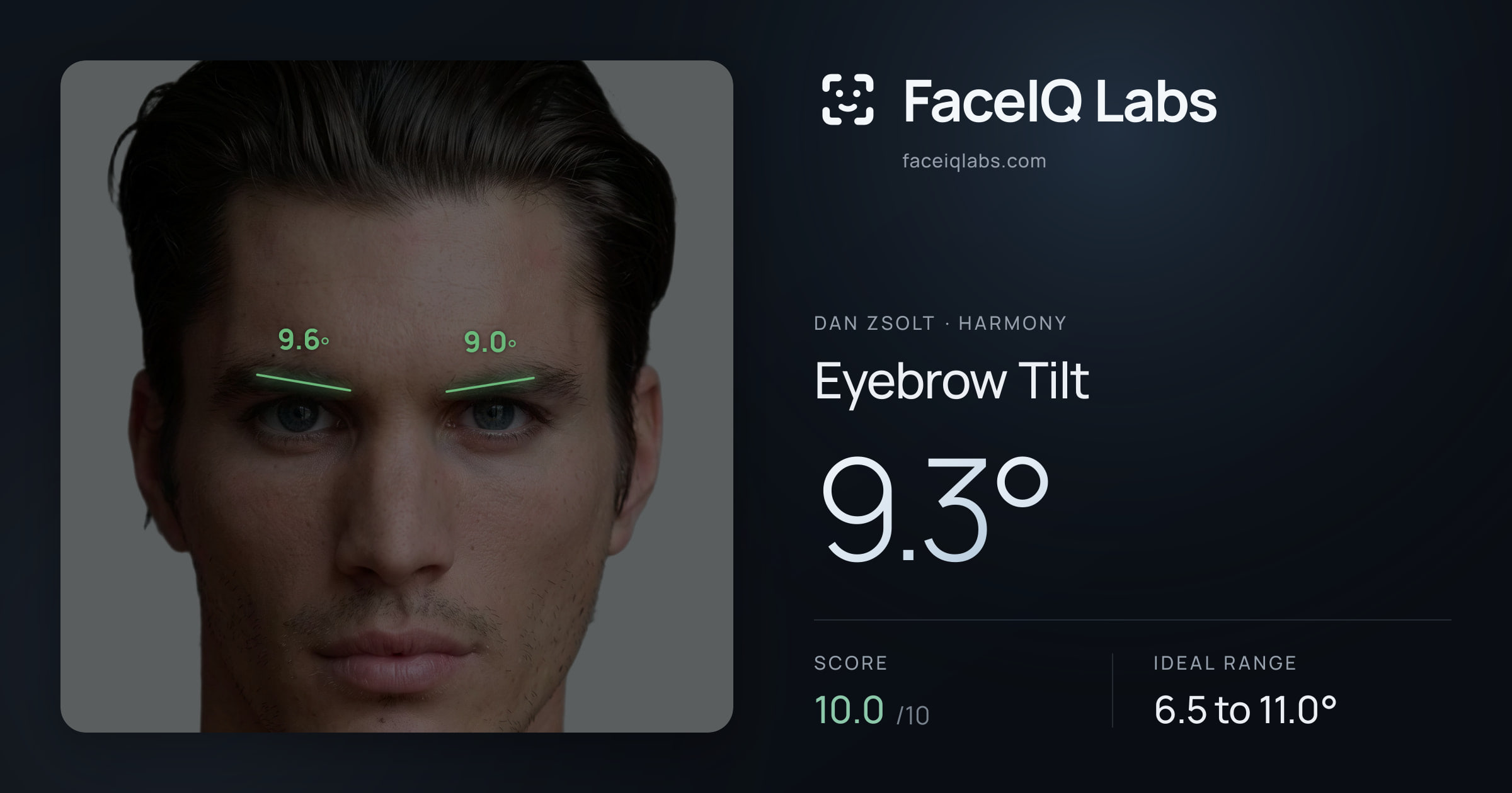 Dan Zsolt Eyebrow Tilt: 9.3°, drawn on the photo