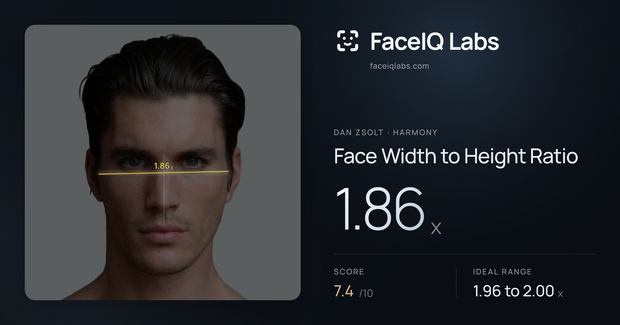 Dan Zsolt Face Width to Height Ratio: 1.86x, drawn on the photo