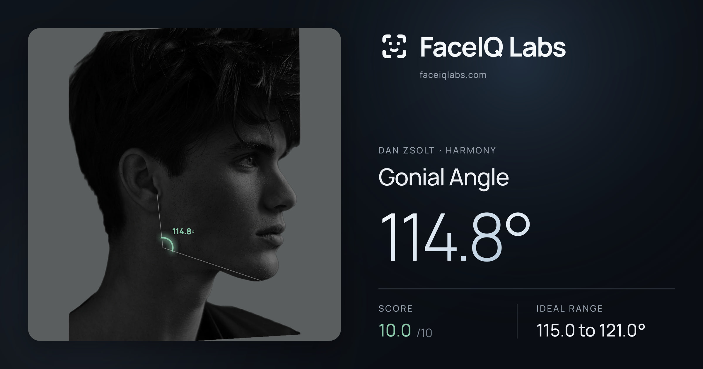 Dan Zsolt Gonial Angle: 114.8°, drawn on the photo
