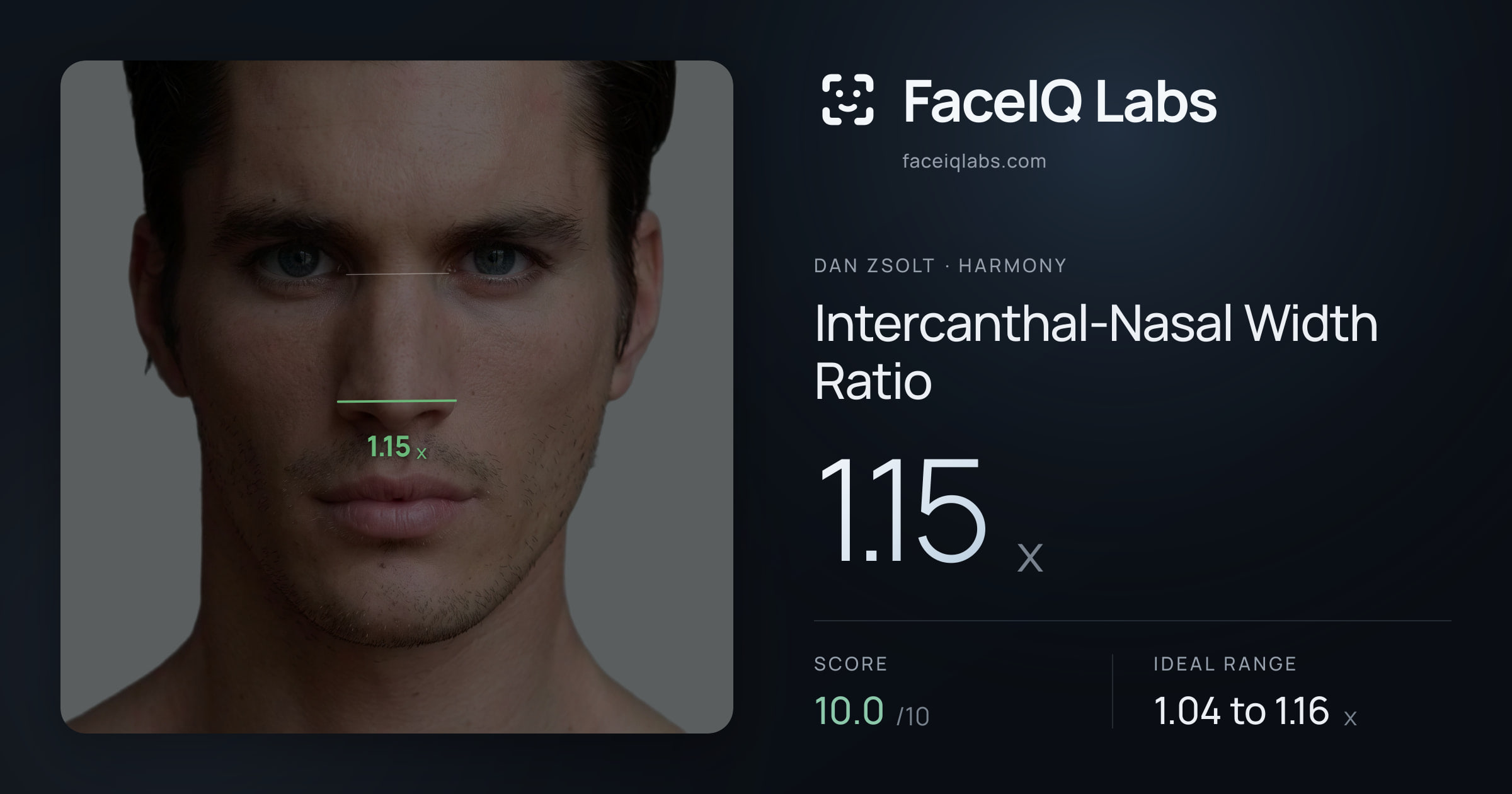 Dan Zsolt Intercanthal-Nasal Width Ratio: 1.15x, drawn on the photo