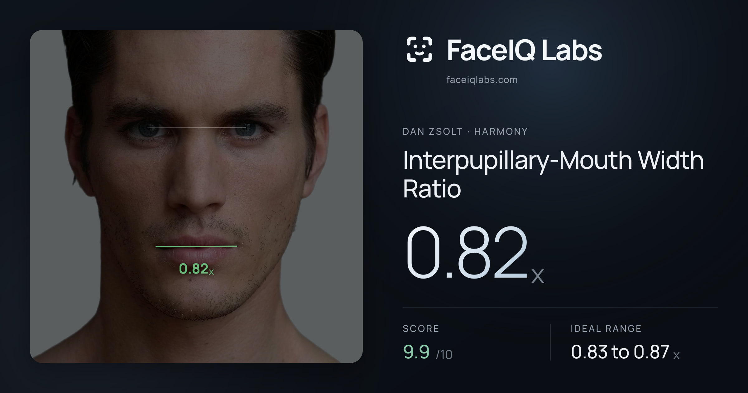 Dan Zsolt Interpupillary-Mouth Width Ratio: 0.82x, drawn on the photo