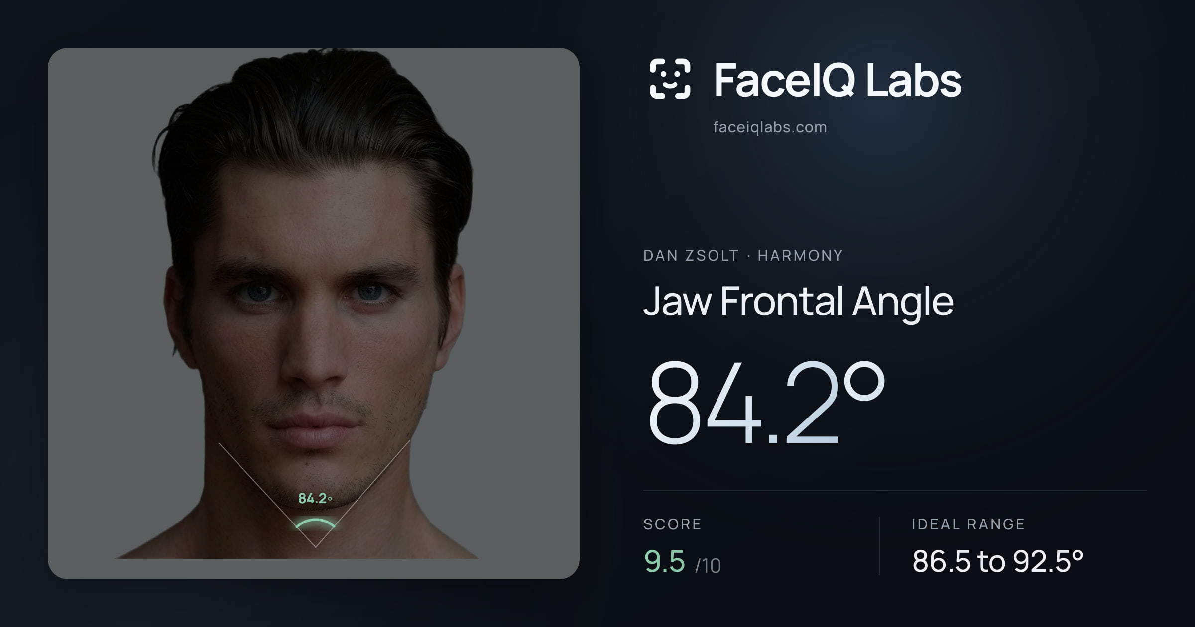 Dan Zsolt Jaw Frontal Angle: 84.2°, drawn on the photo