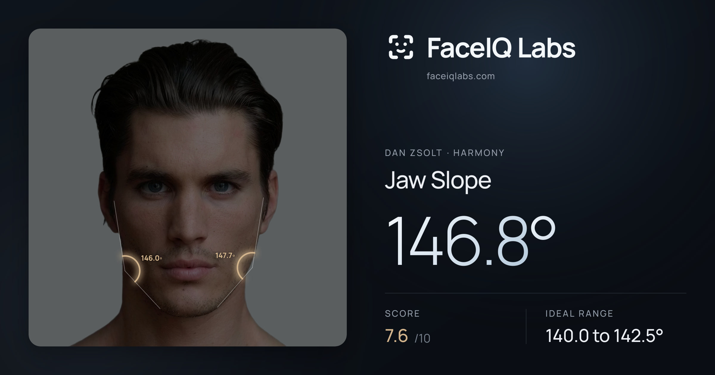 Dan Zsolt Jaw Slope: 146.8°, drawn on the photo