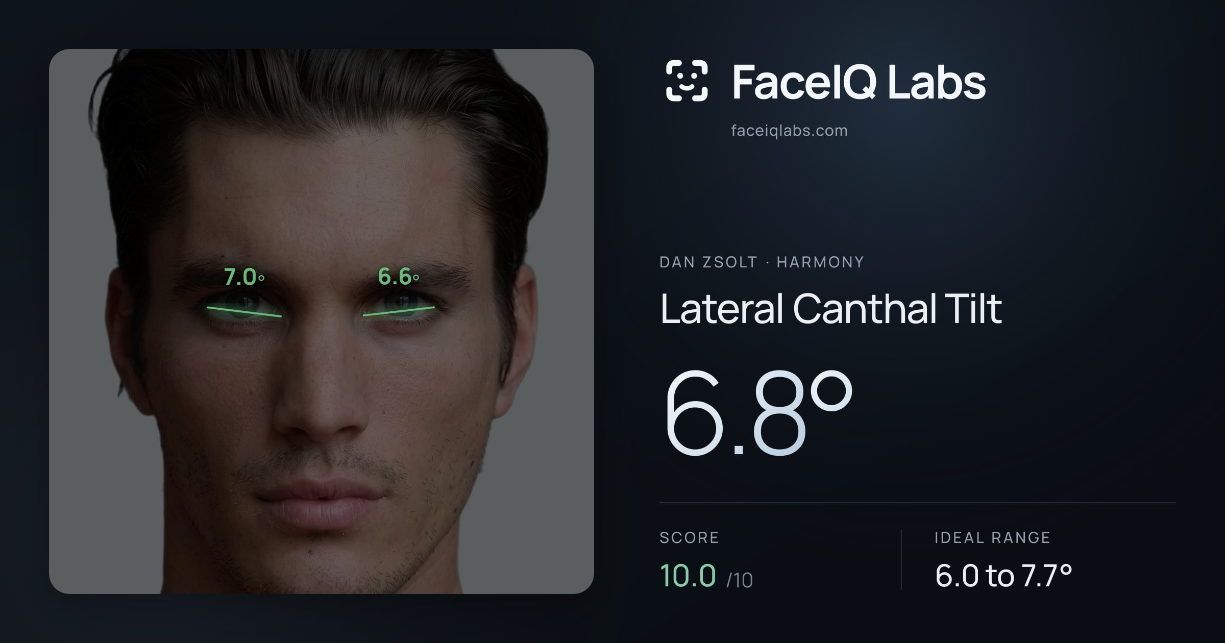 Dan Zsolt Lateral Canthal Tilt: 6.8°, drawn on the photo