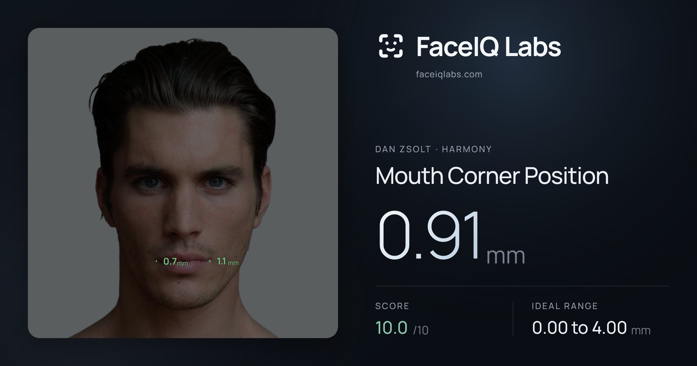 Dan Zsolt Mouth Corner Position: 0.91mm, drawn on the photo