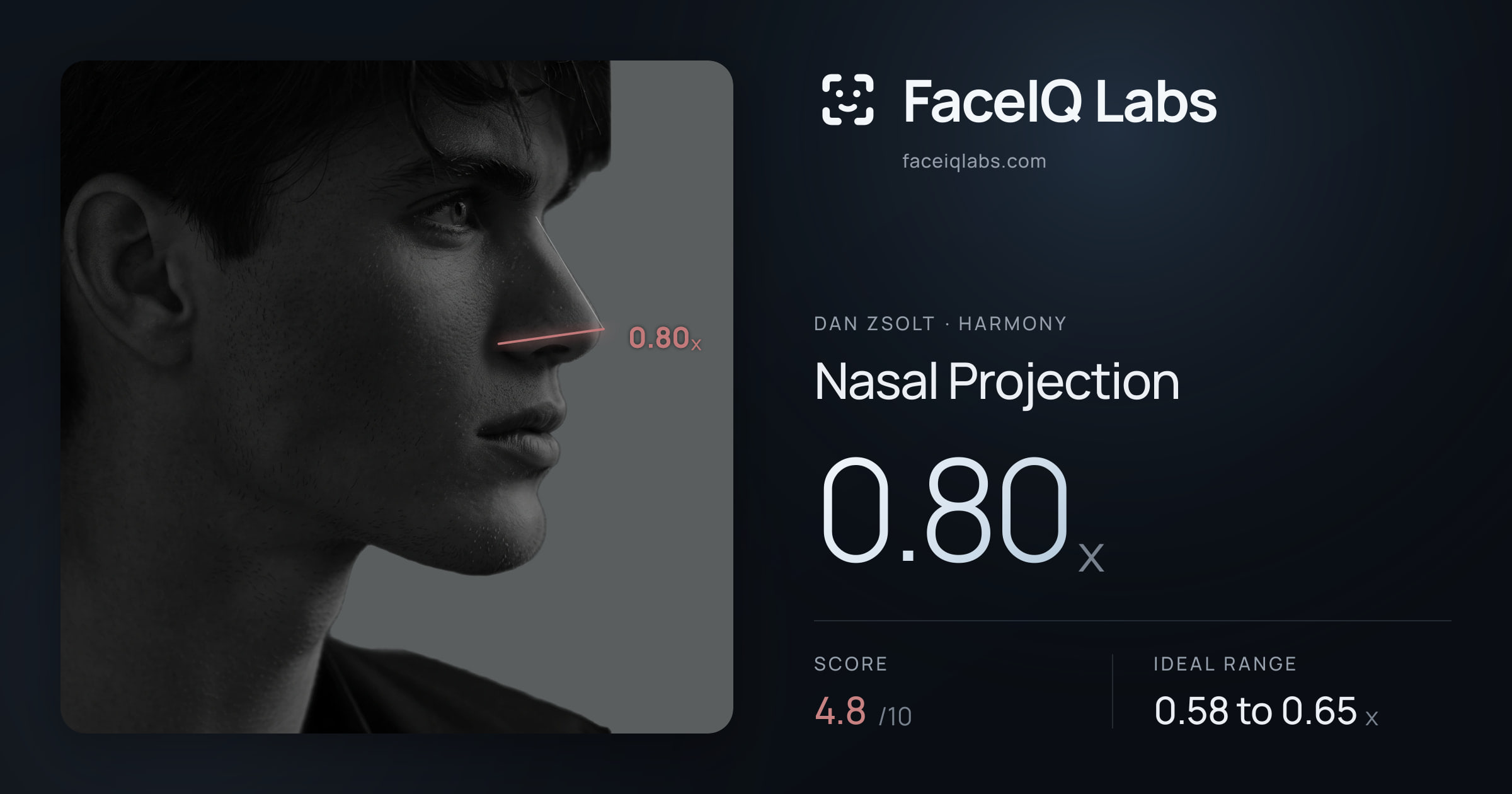 Dan Zsolt Nasal Projection: 0.80x, drawn on the photo