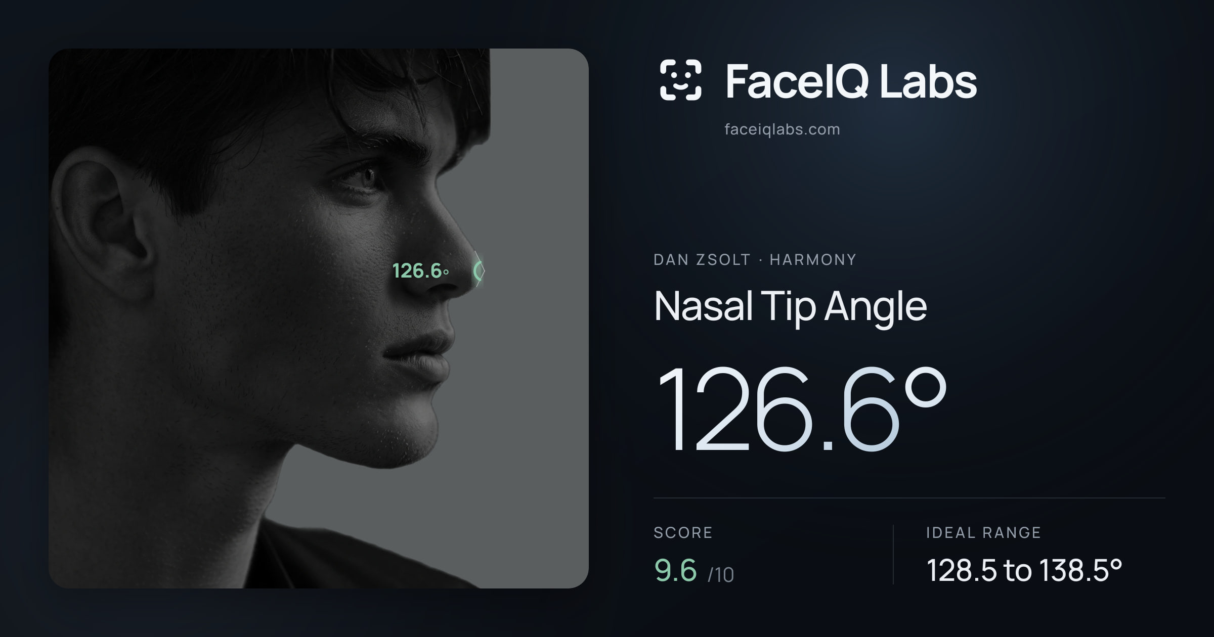 Dan Zsolt Nasal Tip Angle: 126.6°, drawn on the photo