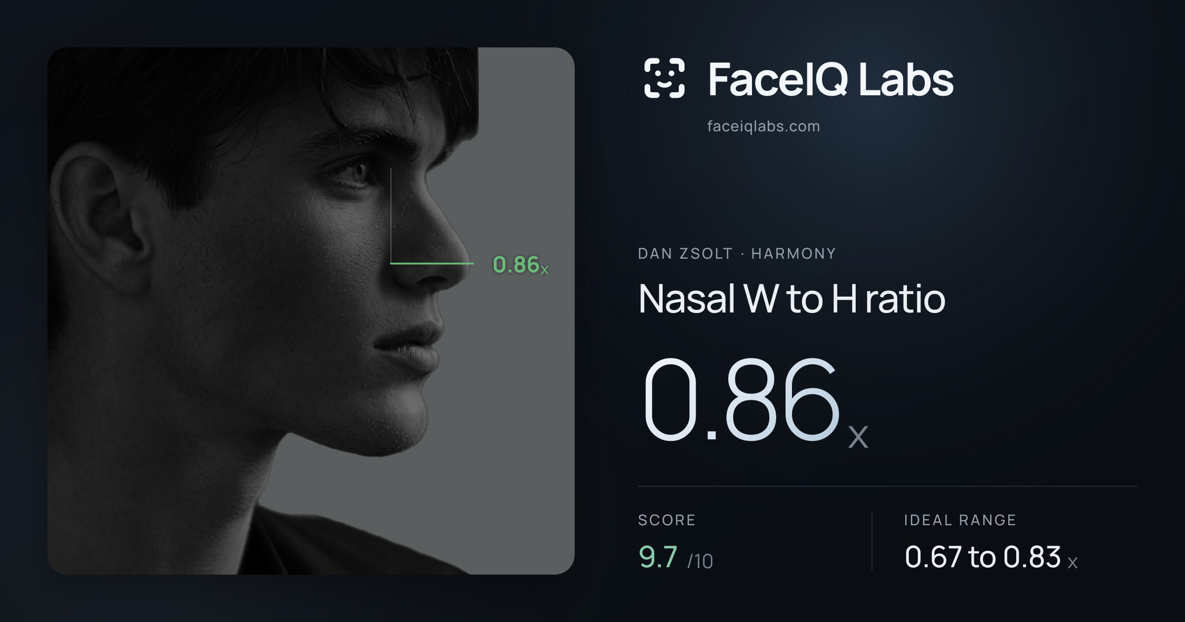 Dan Zsolt Nasal W to H ratio: 0.86x, drawn on the photo