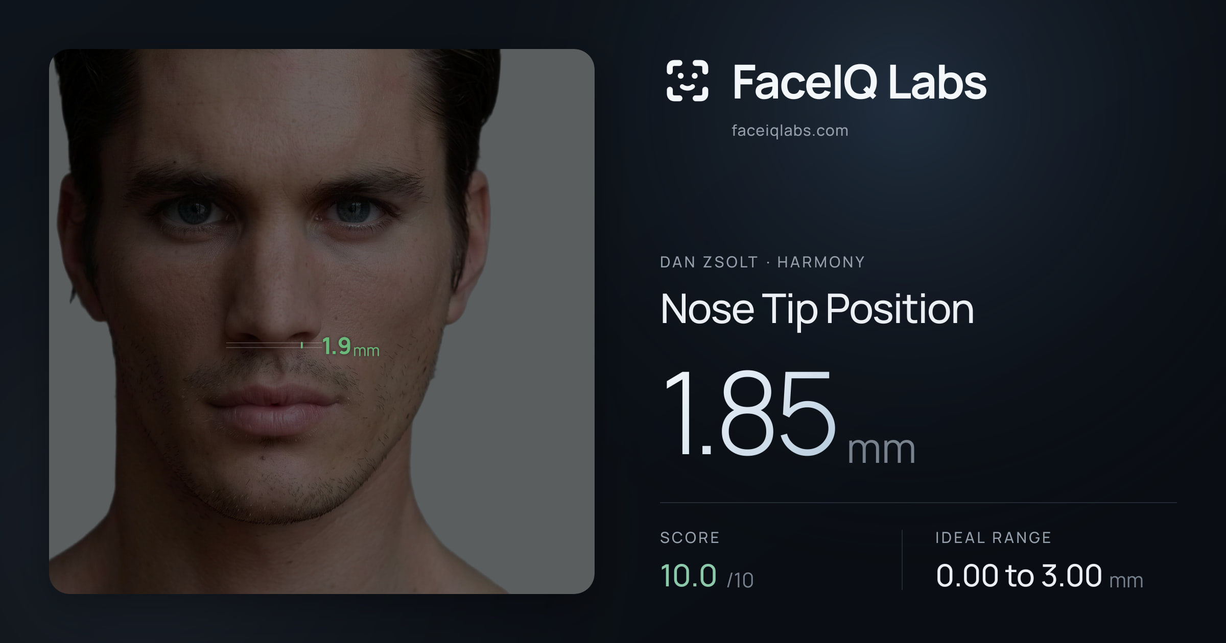 Dan Zsolt Nose Tip Position: 1.85mm, drawn on the photo