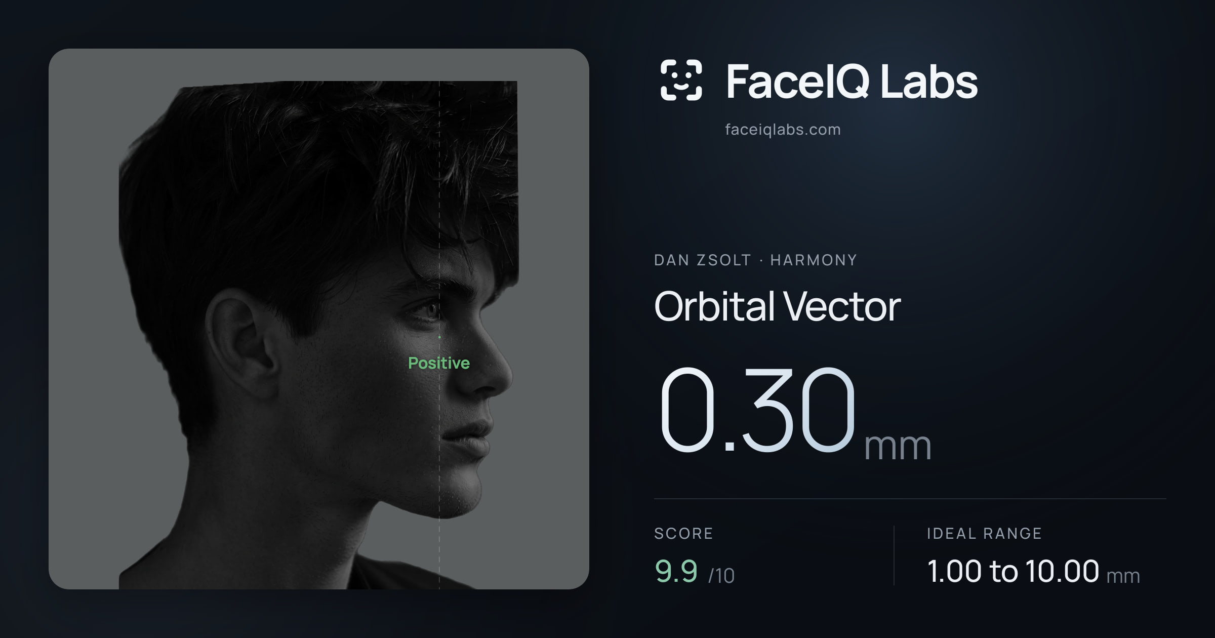 Dan Zsolt Orbital Vector: 0.30mm, drawn on the photo