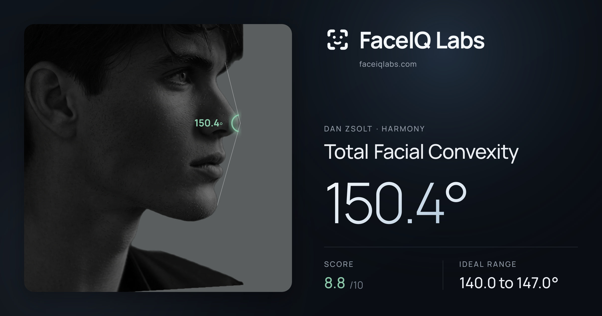Dan Zsolt Total Facial Convexity: 150.4°, drawn on the photo