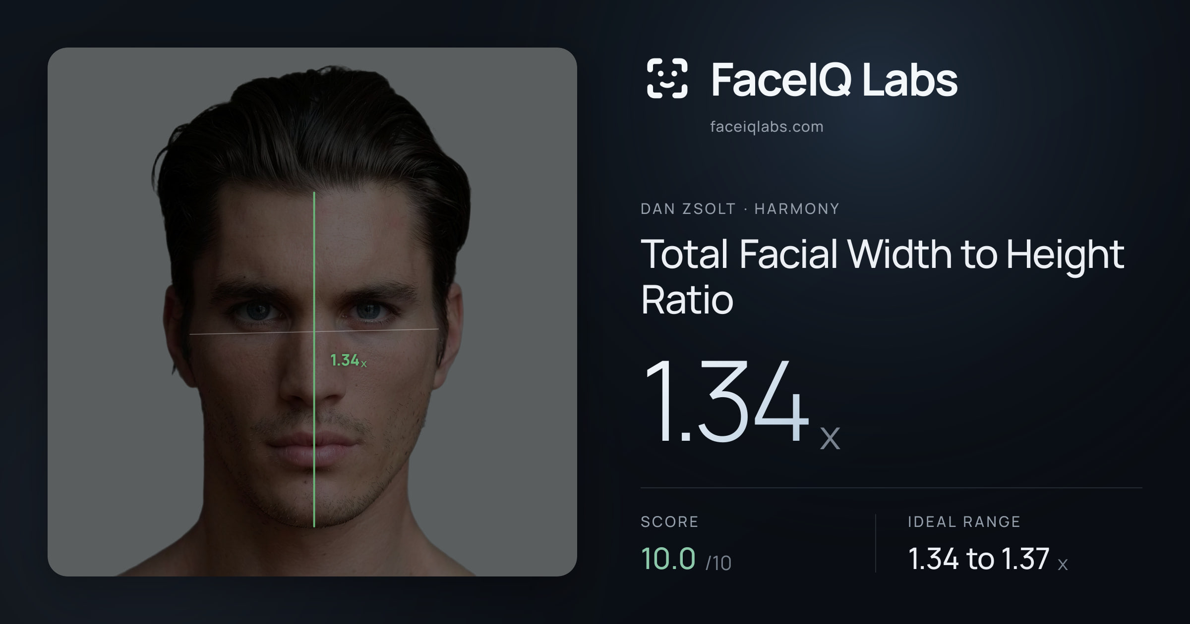 Dan Zsolt Total Facial Width to Height Ratio: 1.34x, drawn on the photo