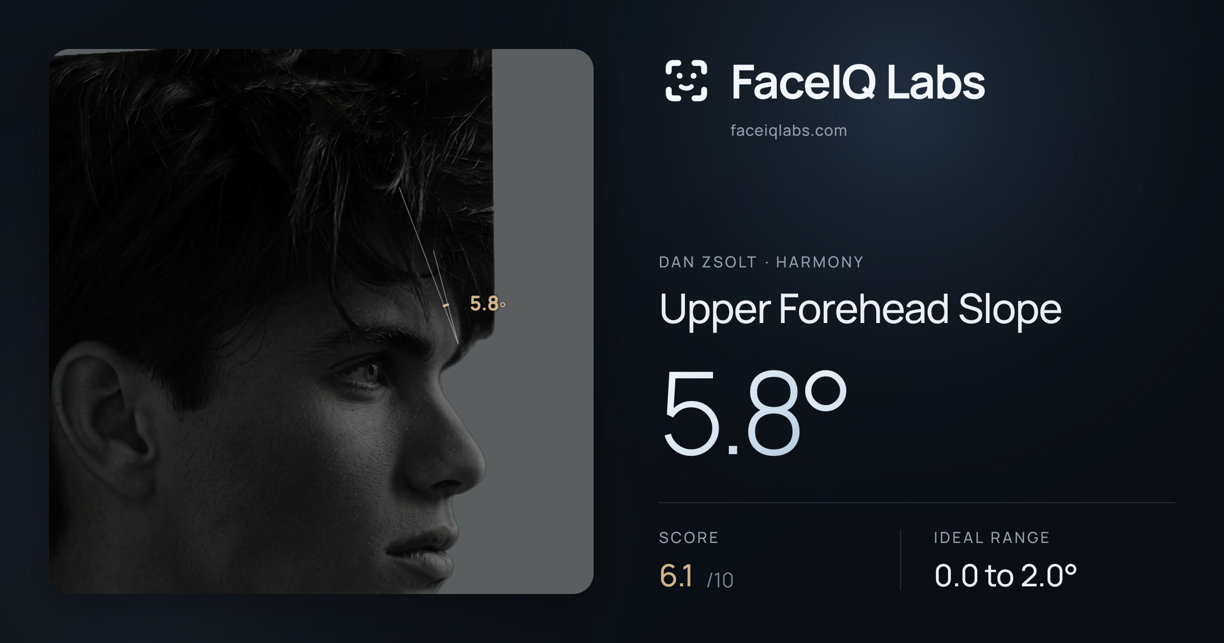 Dan Zsolt Upper Forehead Slope: 5.8°, drawn on the photo