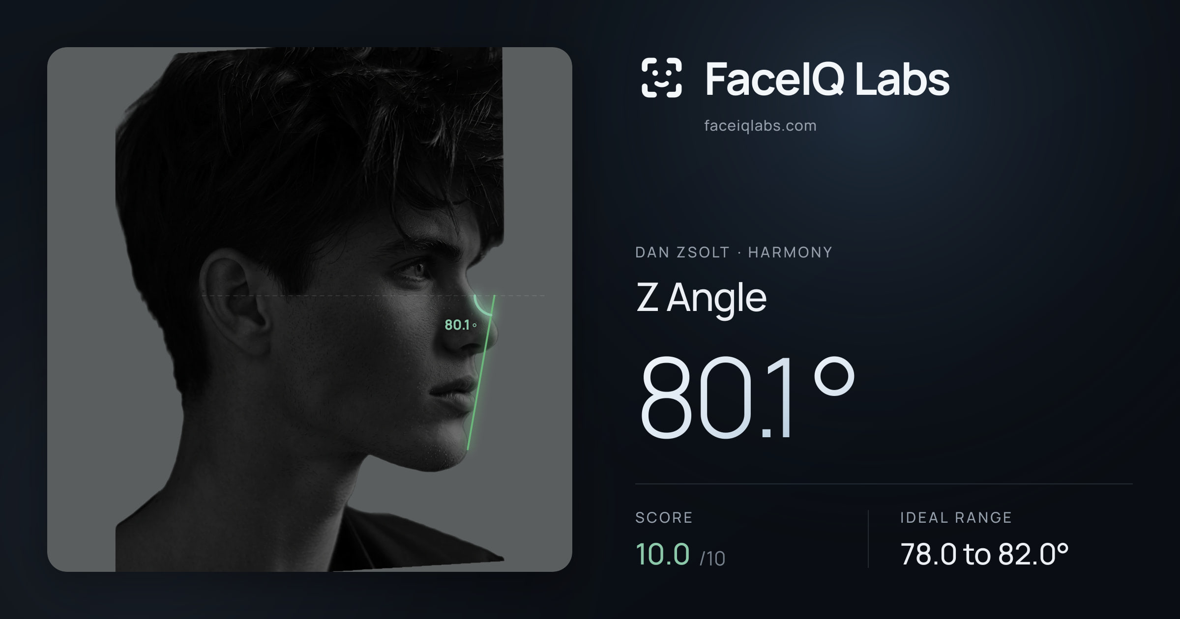 Dan Zsolt Z Angle: 80.1°, drawn on the photo