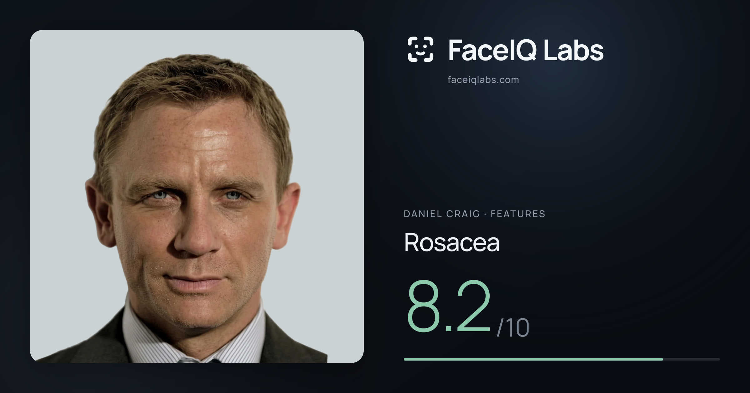 Daniel Craig Rosacea: 8.2/10, drawn on the photo