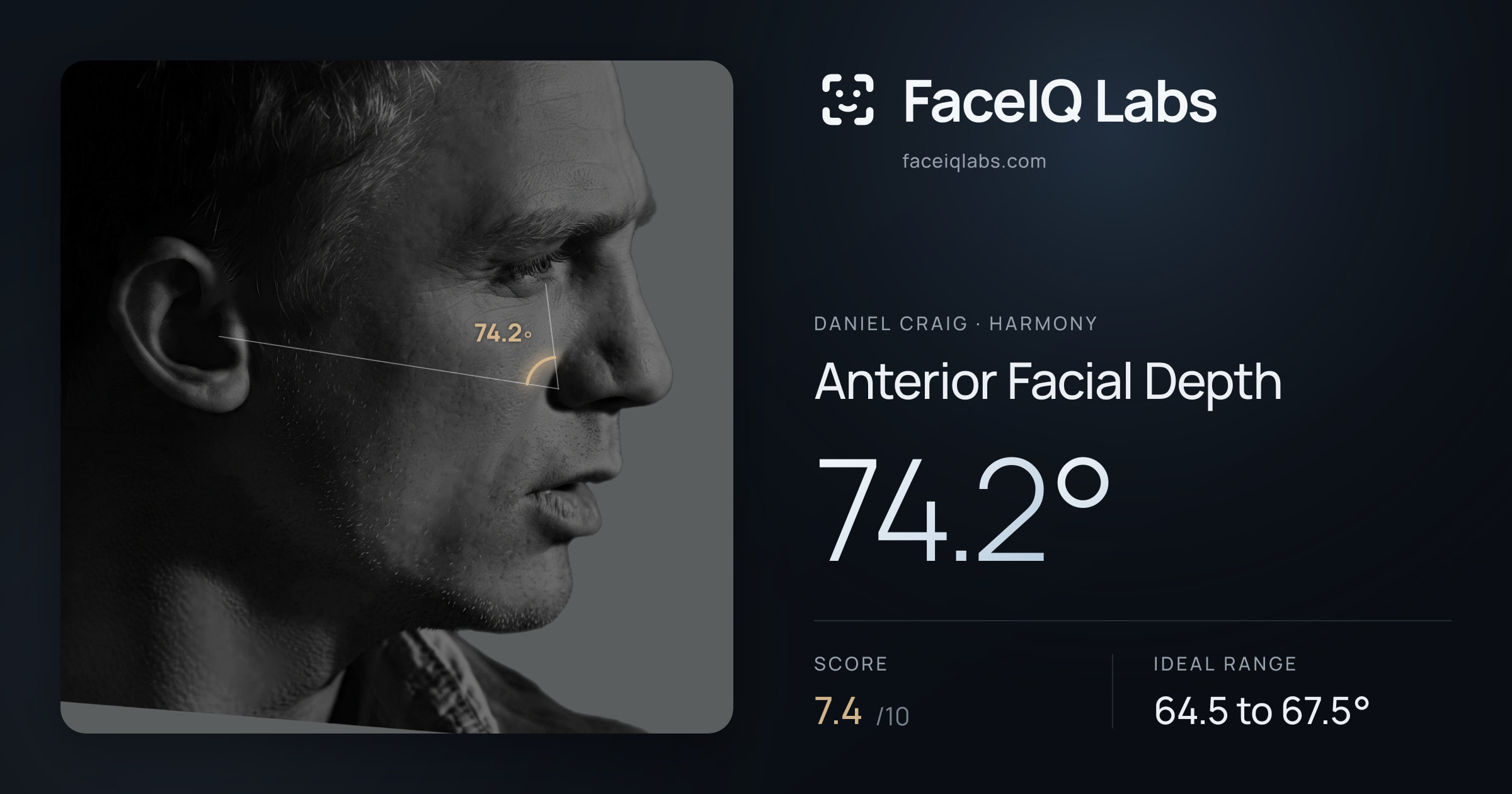Daniel Craig Anterior Facial Depth: 74.2°, drawn on the photo