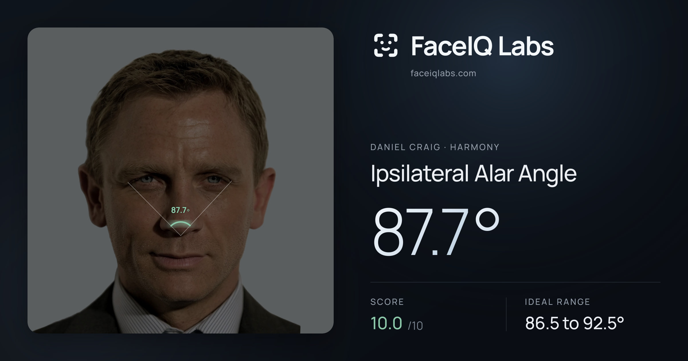 Daniel Craig Ipsilateral Alar Angle: 87.7°, drawn on the photo