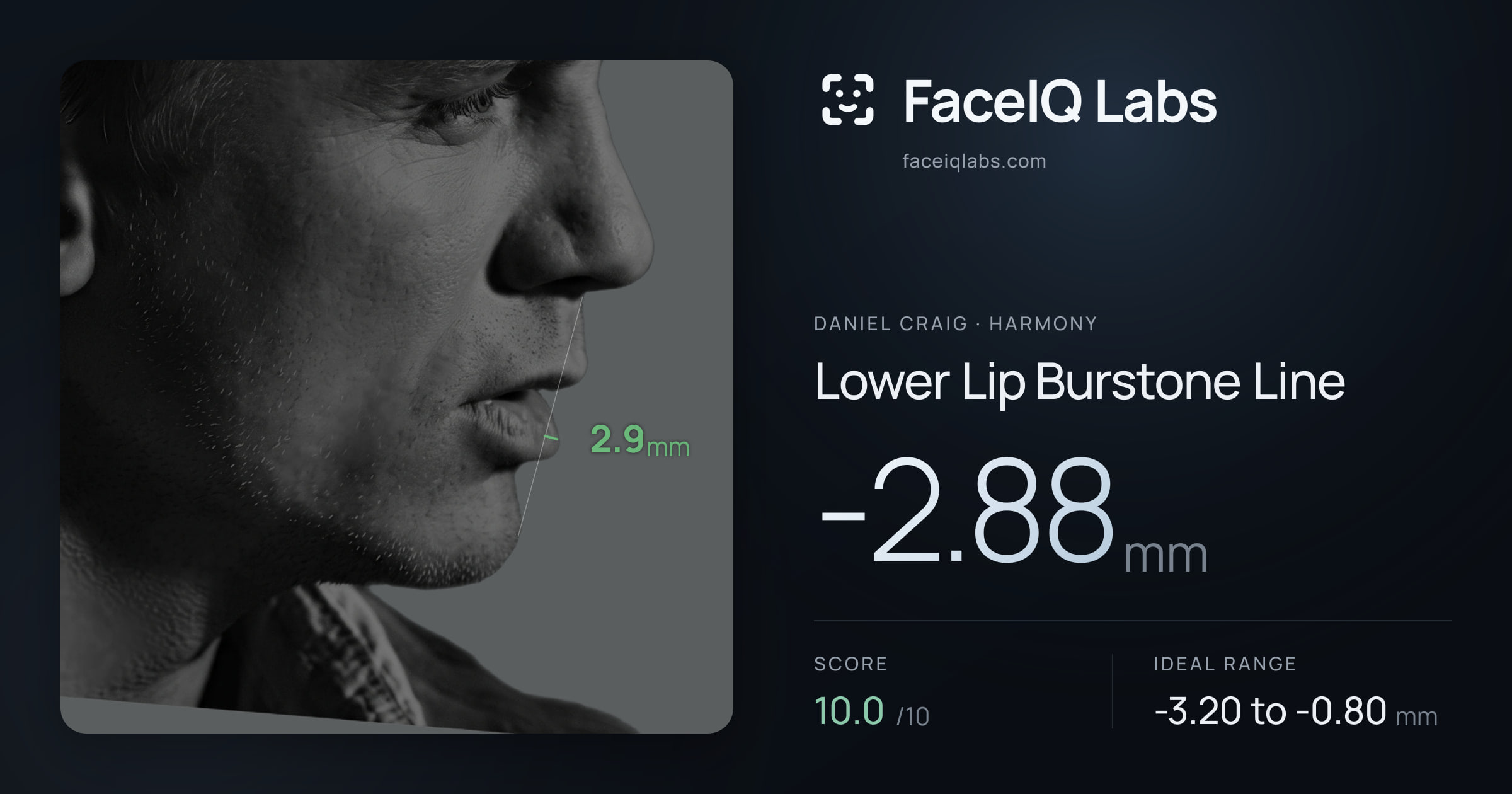 Daniel Craig Lower Lip Burstone Line: -2.88mm, drawn on the photo