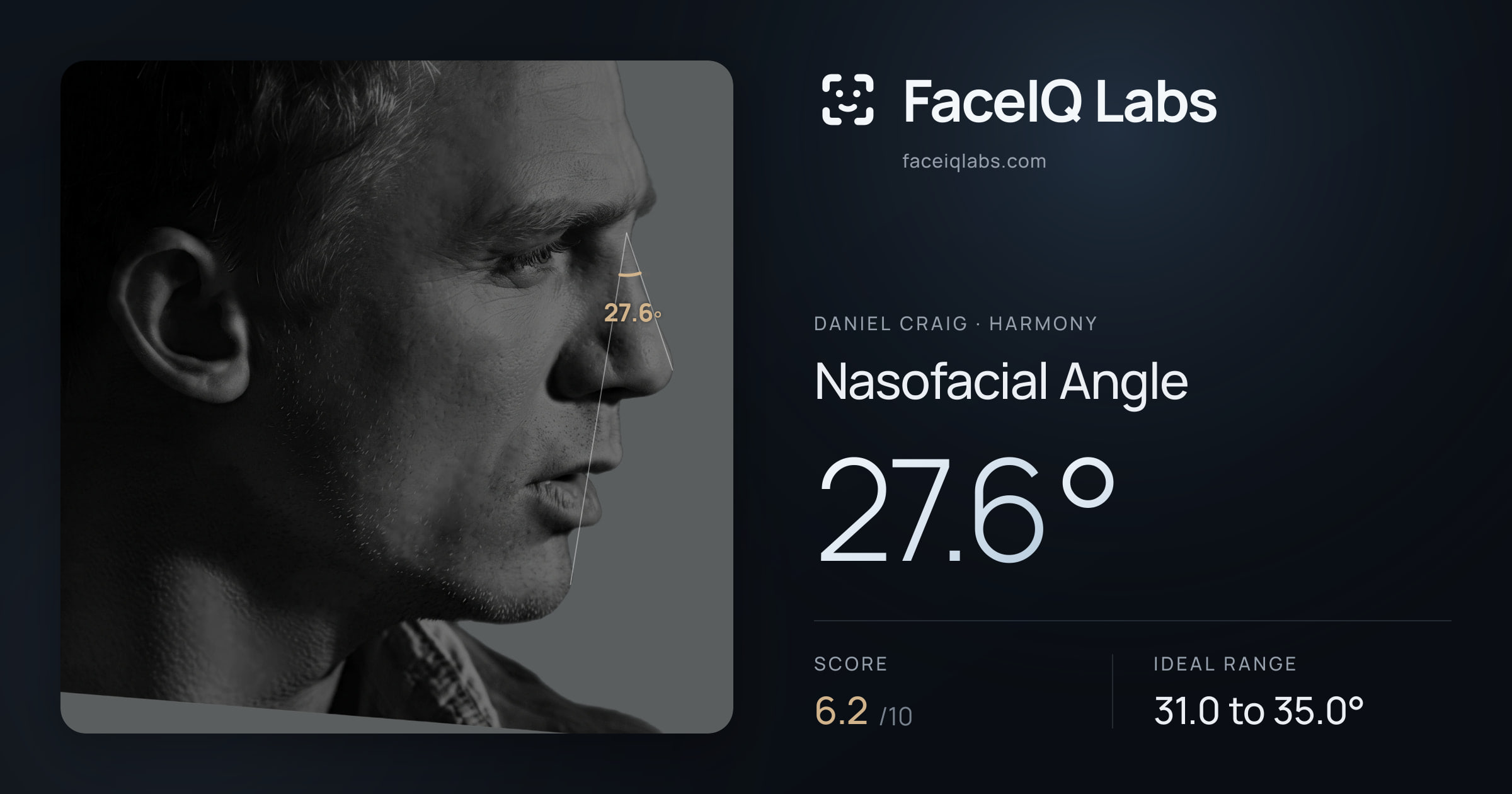 Daniel Craig Nasofacial Angle: 27.6°, drawn on the photo