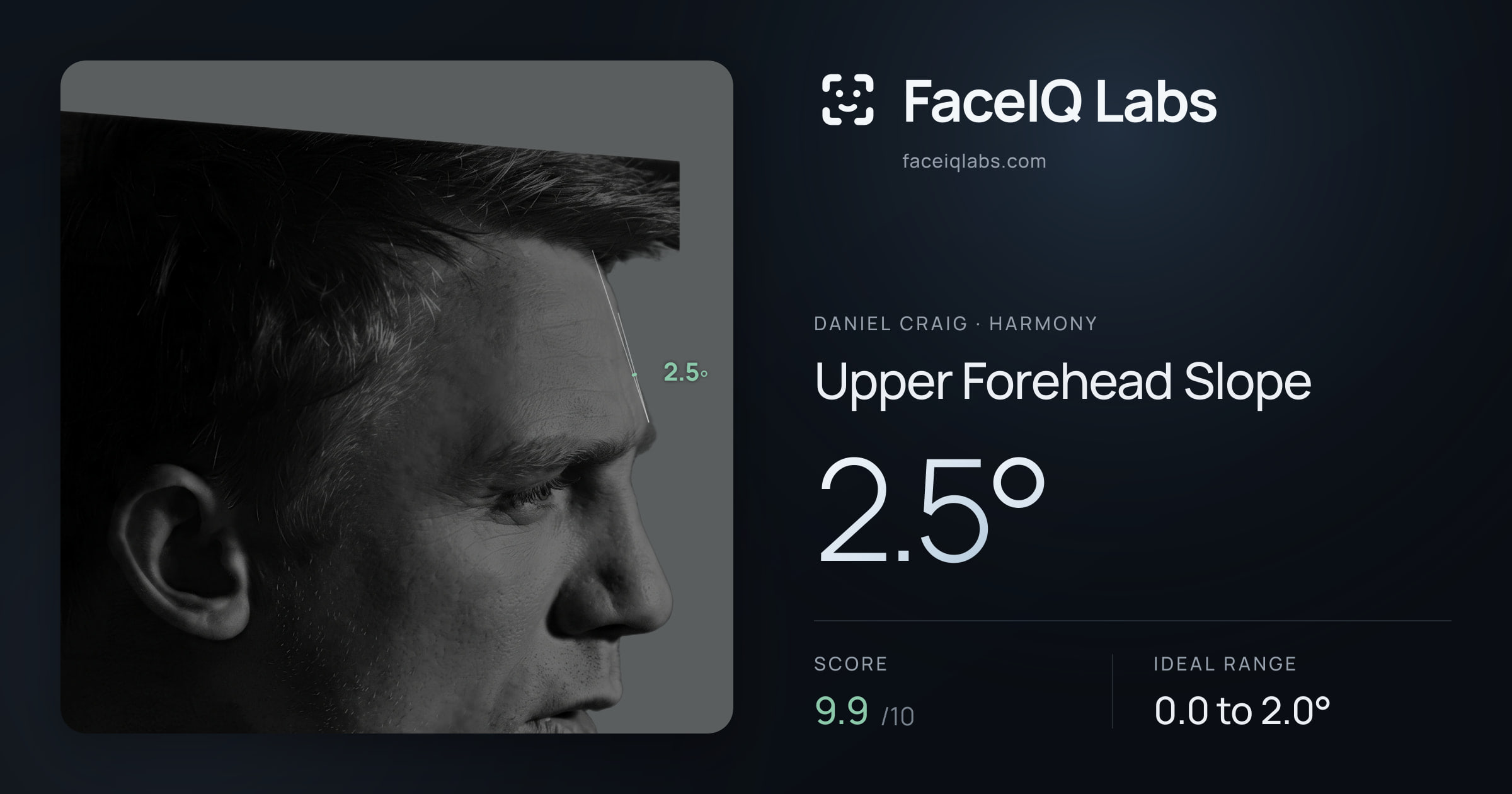 Daniel Craig Upper Forehead Slope: 2.5°, drawn on the photo