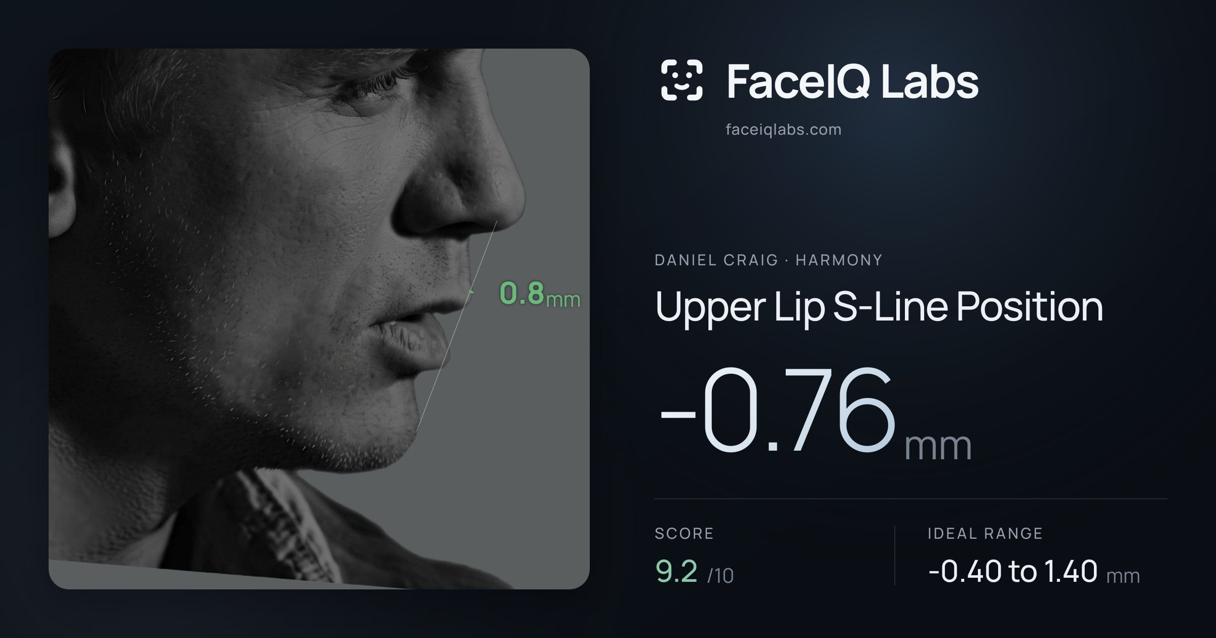 Daniel Craig Upper Lip S-Line Position: -0.76mm, drawn on the photo