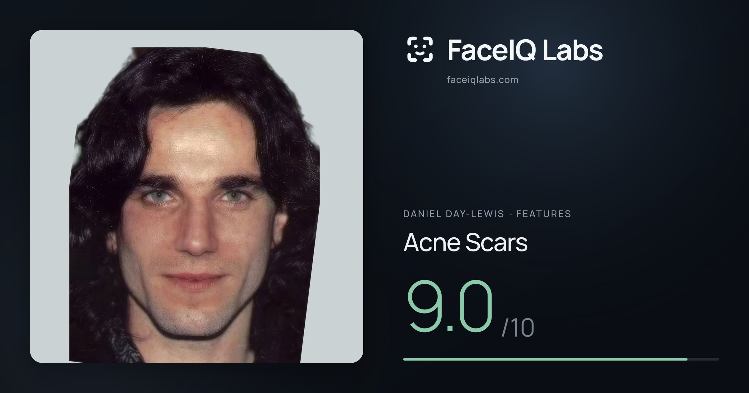 Daniel Day-Lewis Acne Scars: 9.0/10, drawn on the photo