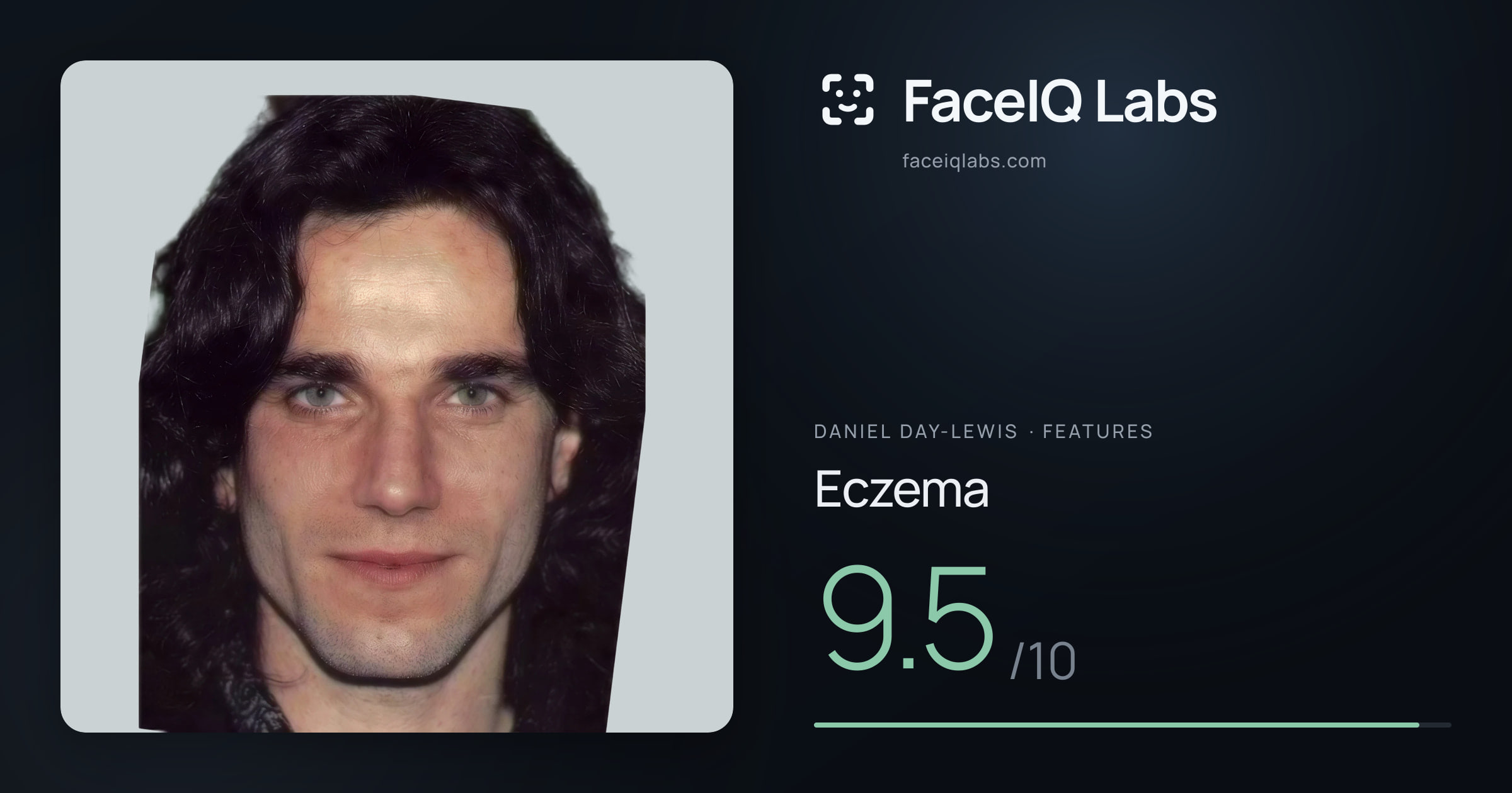 Daniel Day-Lewis Eczema: 9.5/10, drawn on the photo