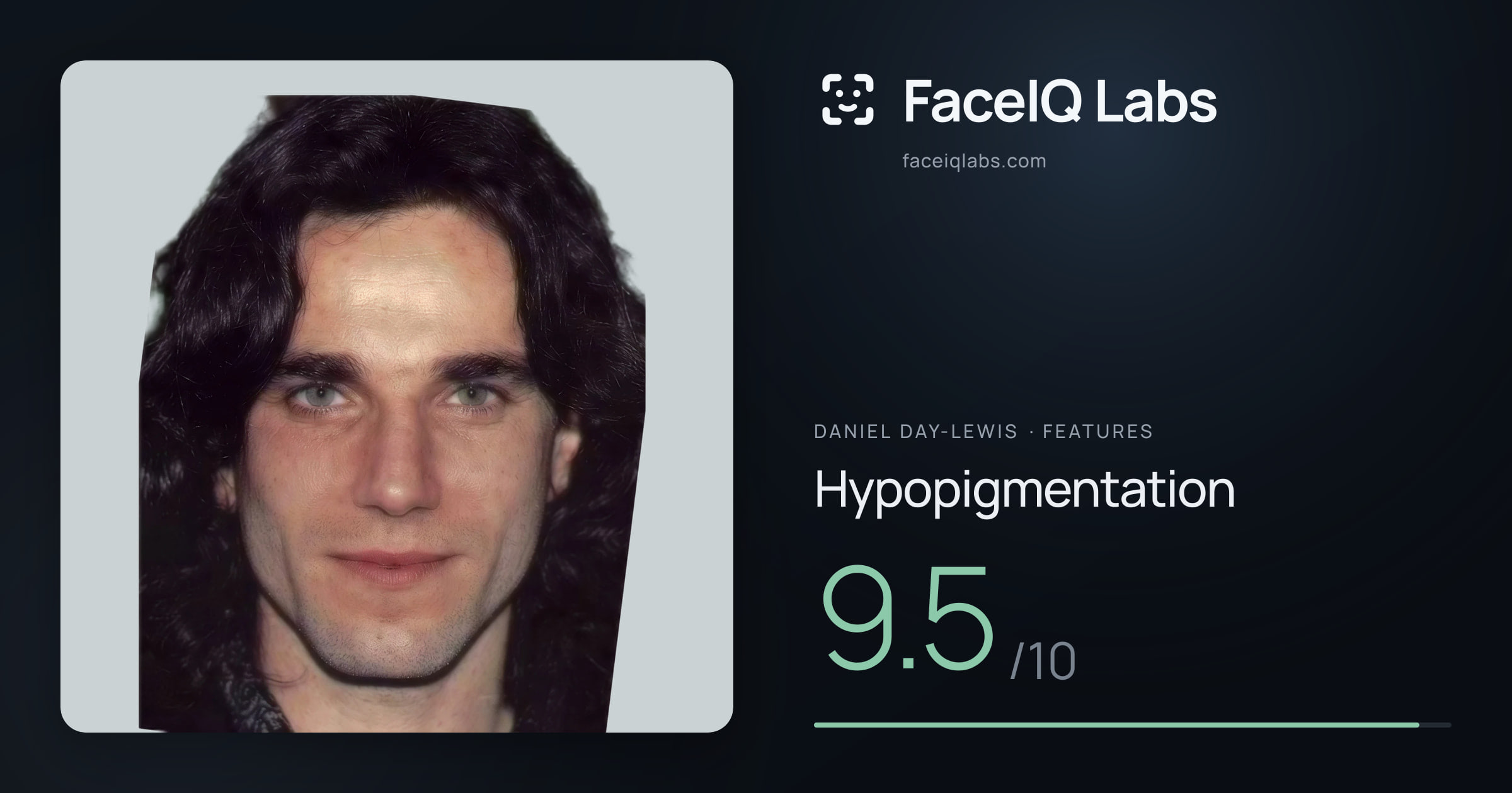 Daniel Day-Lewis Hypopigmentation: 9.5/10, drawn on the photo