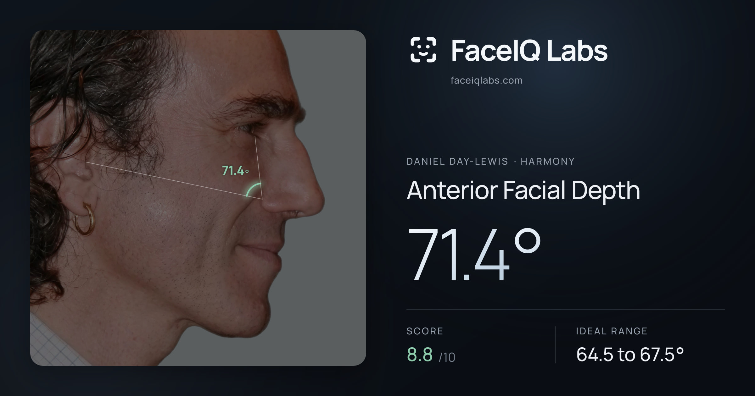 Daniel Day-Lewis Anterior Facial Depth: 71.4°, drawn on the photo