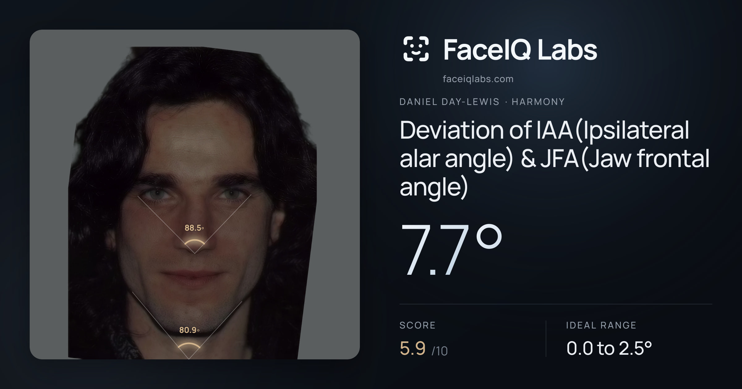 Daniel Day-Lewis Deviation of IAA(Ipsilateral alar angle) & JFA(Jaw frontal angle): 7.7°, drawn on the photo