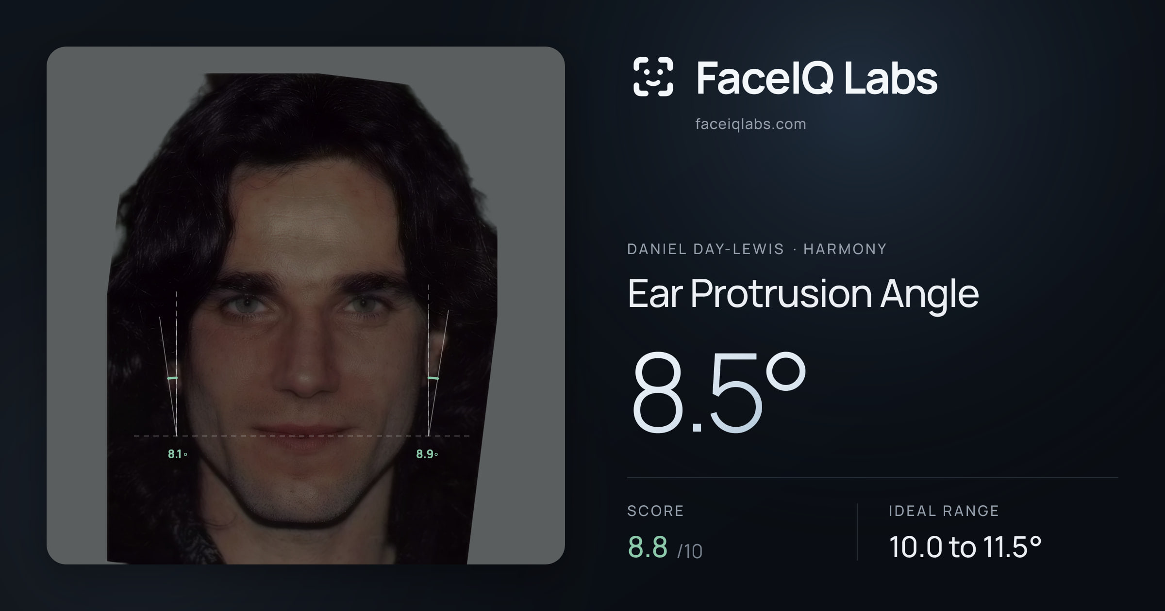 Daniel Day-Lewis Ear Protrusion Angle: 9.9°, drawn on the photo
