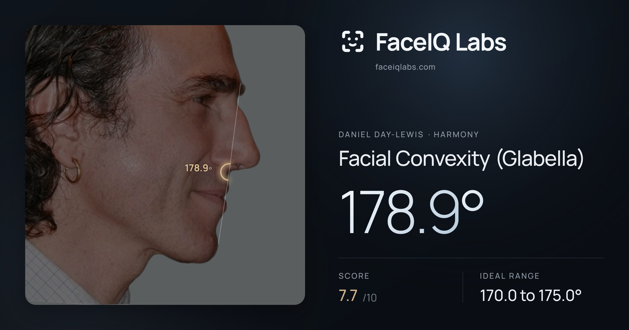 Daniel Day-Lewis Facial Convexity (Glabella): 178.9°, drawn on the photo