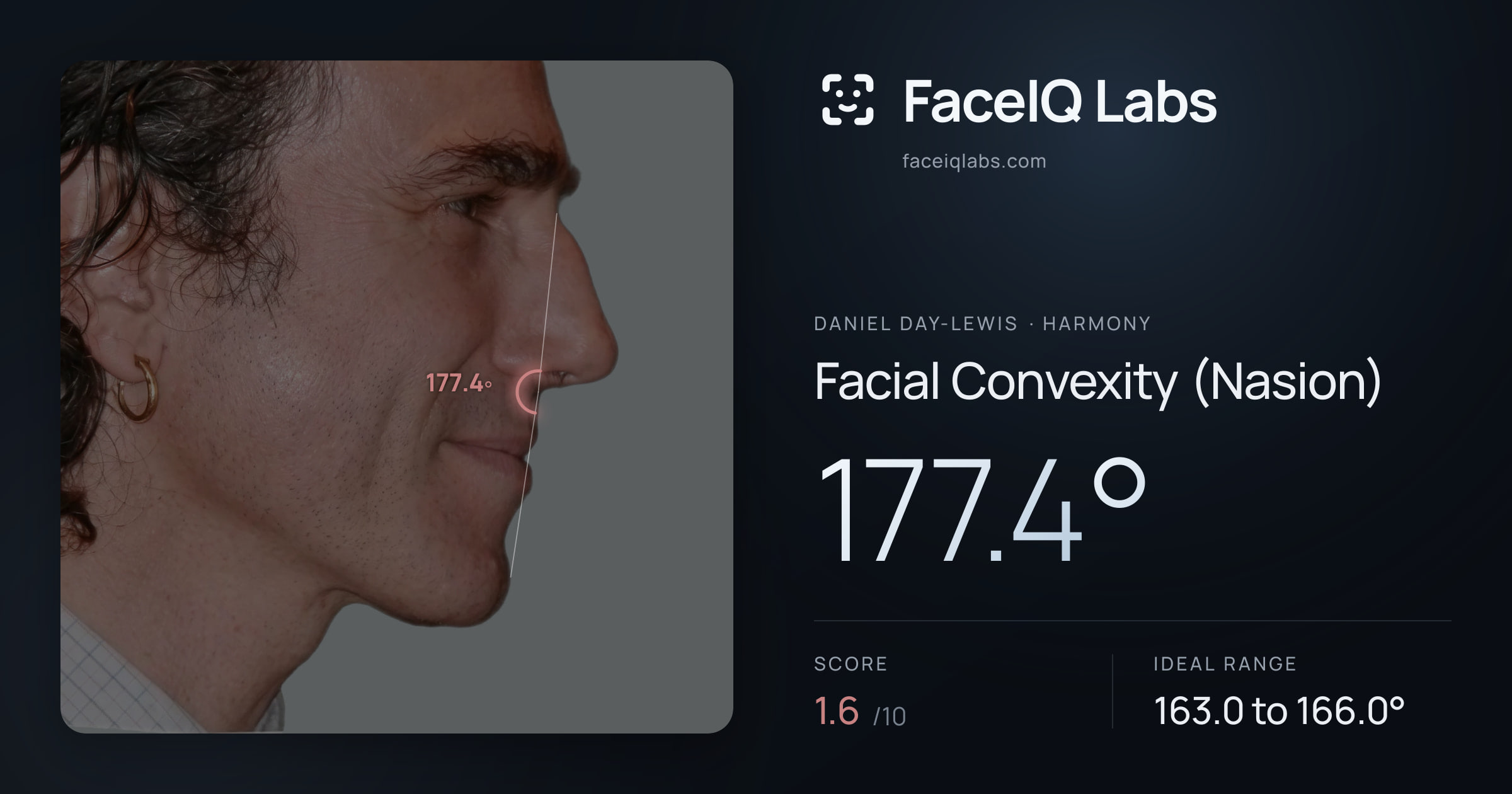 Daniel Day-Lewis Facial Convexity (Nasion): 177.4°, drawn on the photo