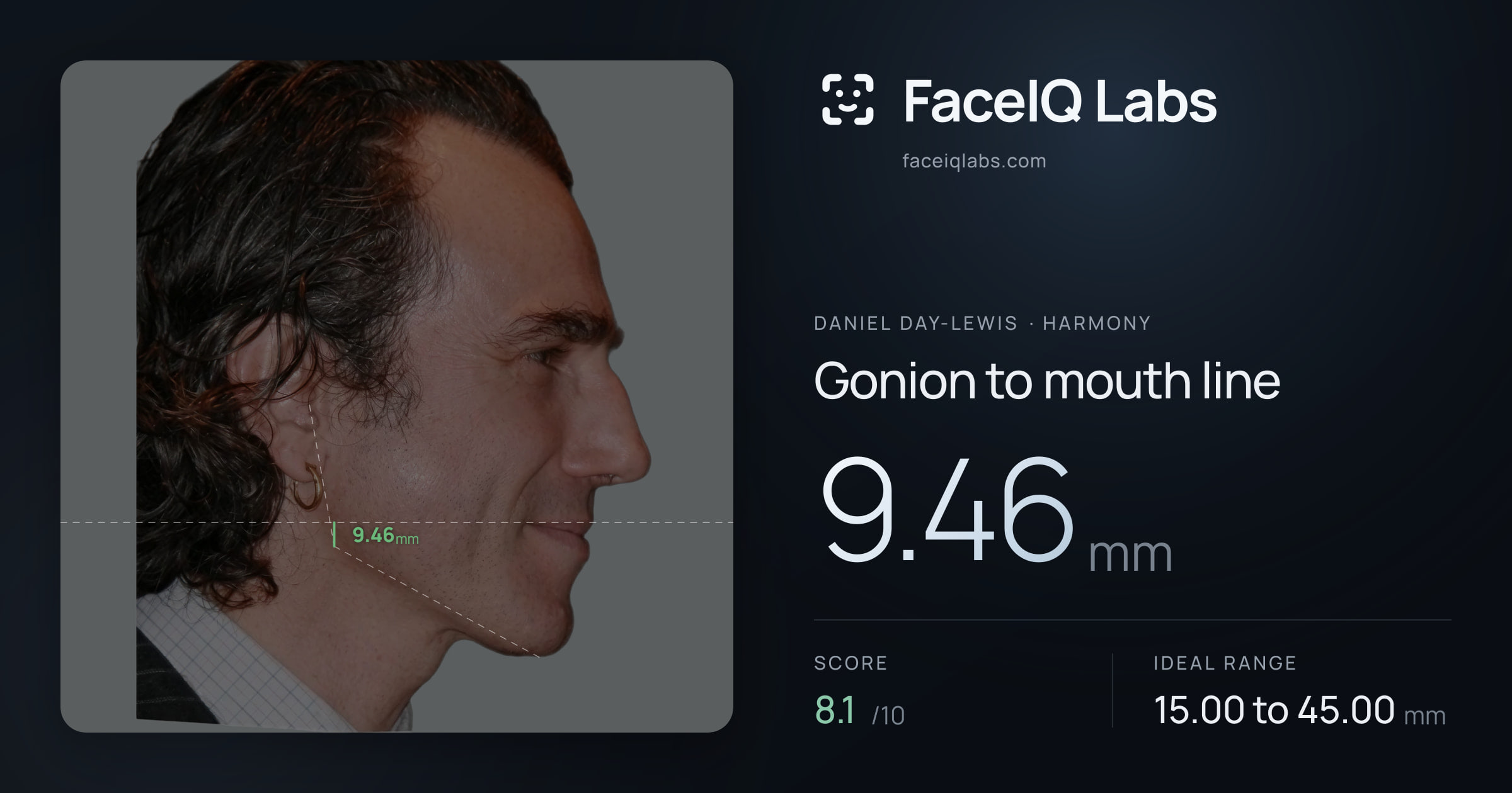 Daniel Day-Lewis Gonion to mouth line: 9.46mm, drawn on the photo