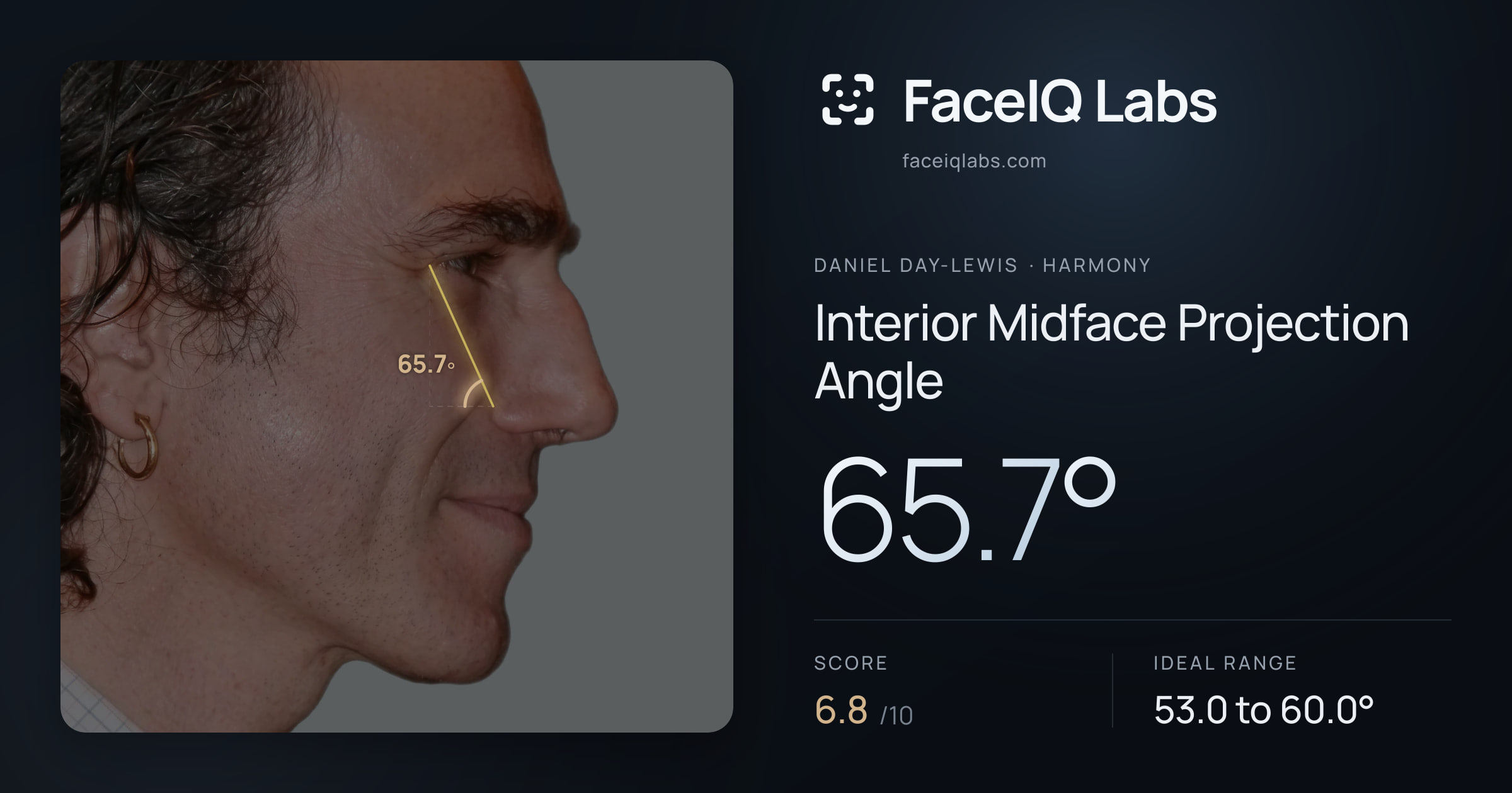 Daniel Day-Lewis Interior Midface Projection Angle: 65.7°, drawn on the photo