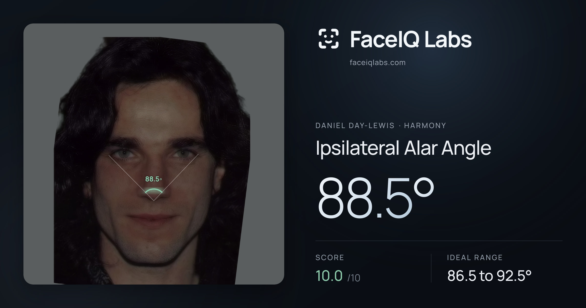 Daniel Day-Lewis Ipsilateral Alar Angle: 88.5°, drawn on the photo
