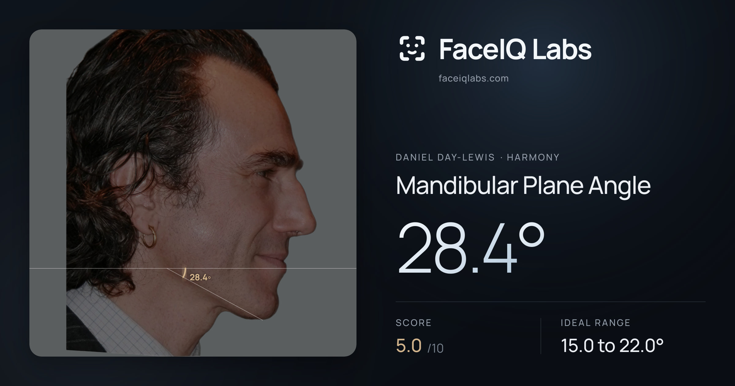 Daniel Day-Lewis Mandibular Plane Angle: 28.4°, drawn on the photo