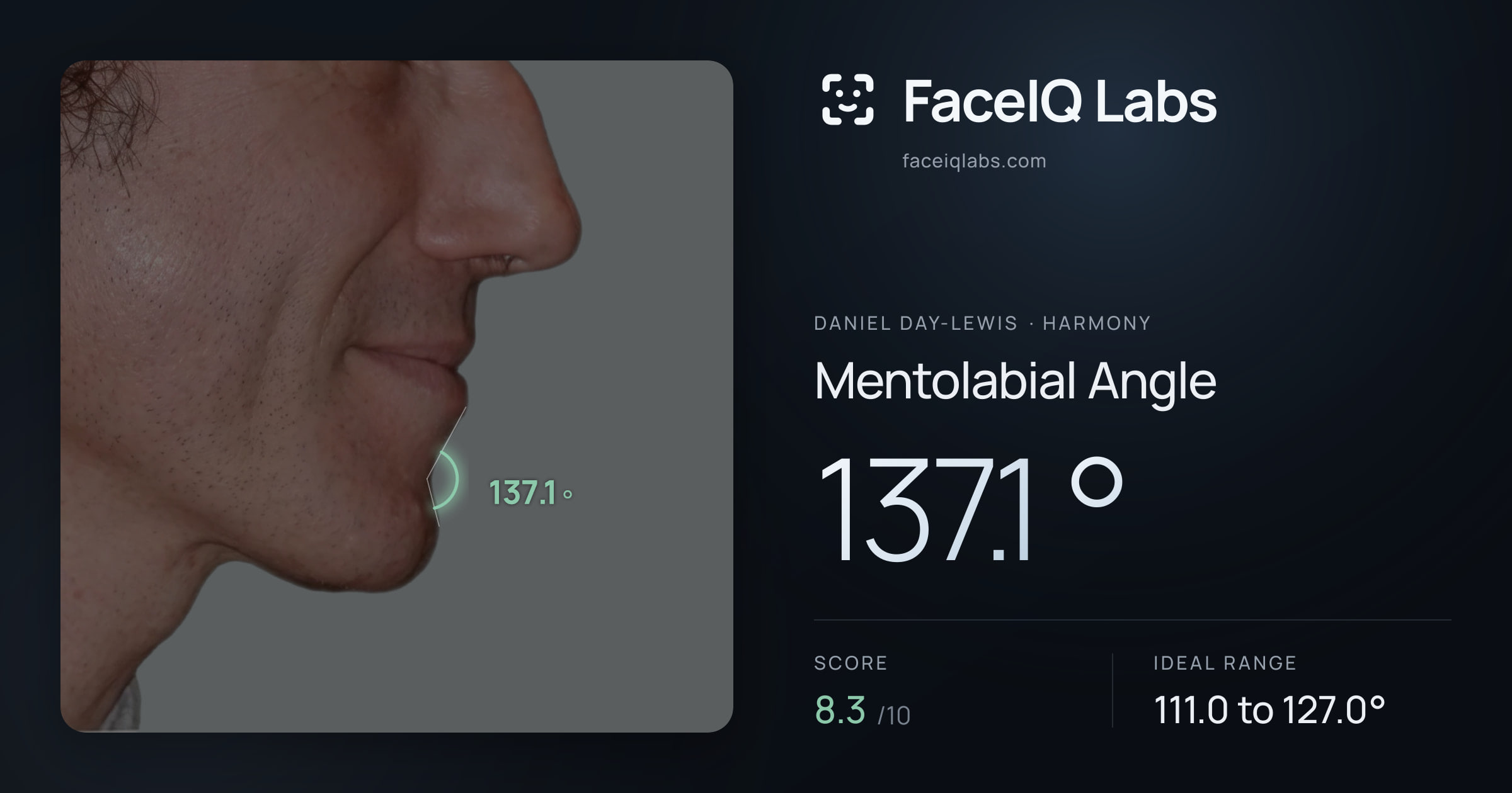 Daniel Day-Lewis Mentolabial Angle: 137.1°, drawn on the photo