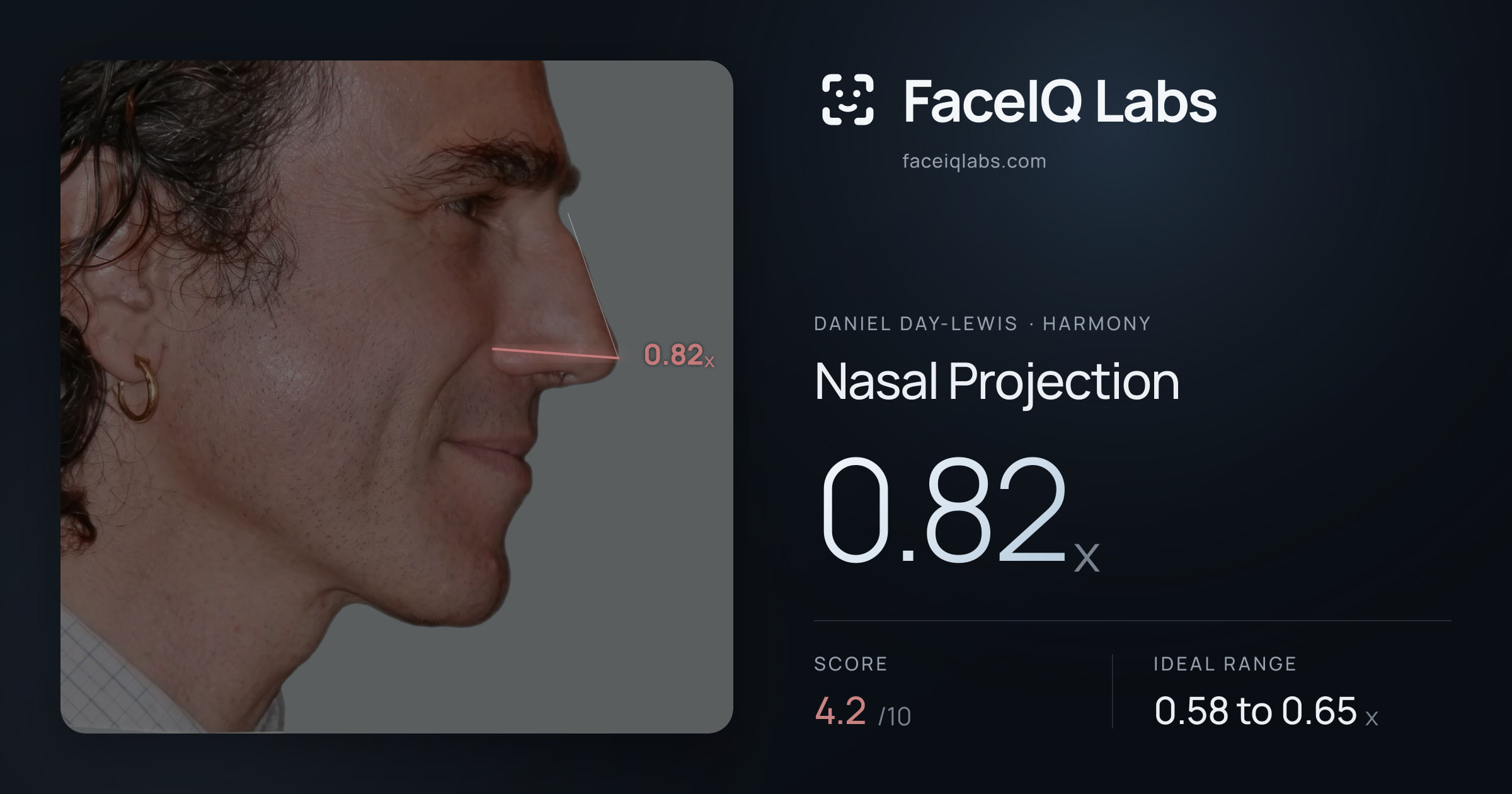 Daniel Day-Lewis Nasal Projection: 0.82x, drawn on the photo