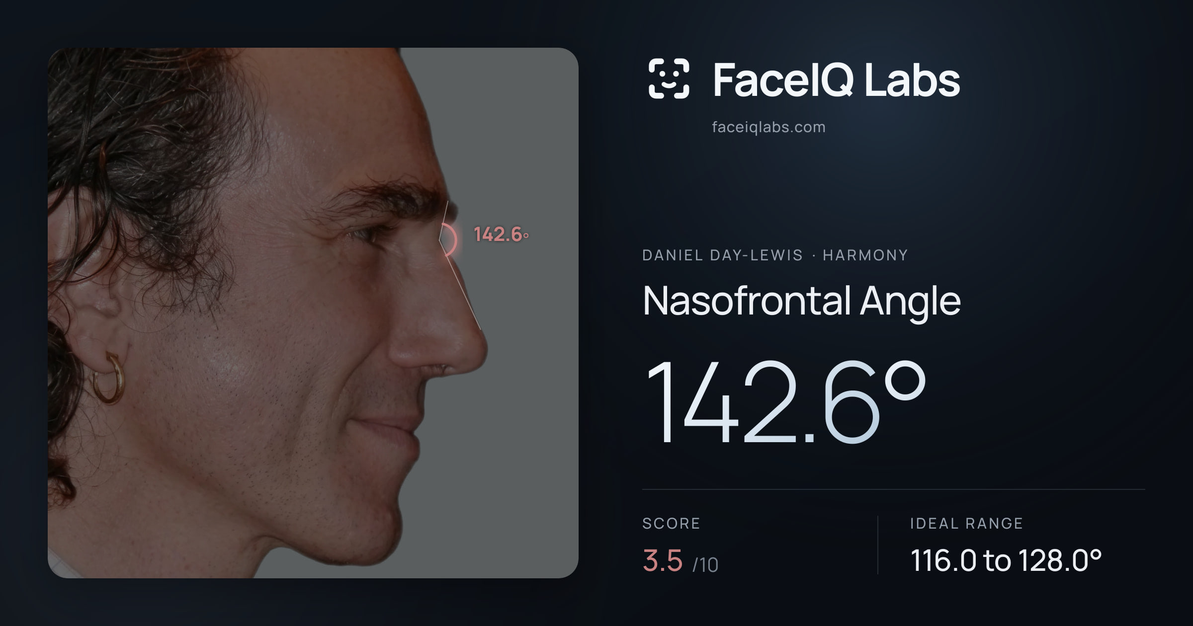 Daniel Day-Lewis Nasofrontal Angle: 142.6°, drawn on the photo