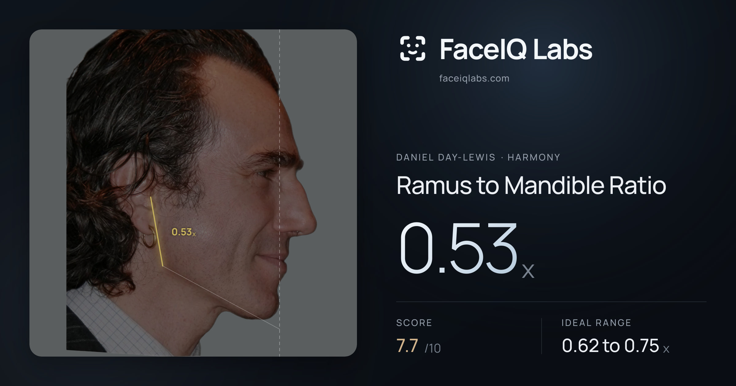Daniel Day-Lewis Ramus to Mandible Ratio: 0.53x, drawn on the photo
