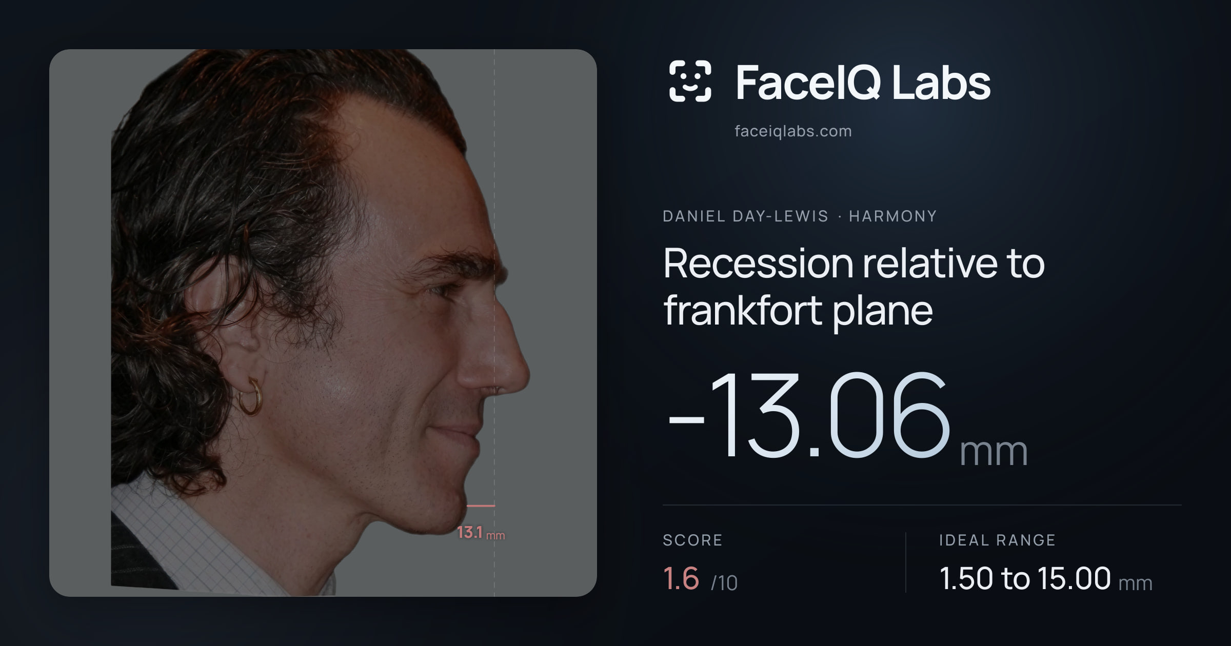 Daniel Day-Lewis Recession relative to frankfort plane: -13.06mm, drawn on the photo