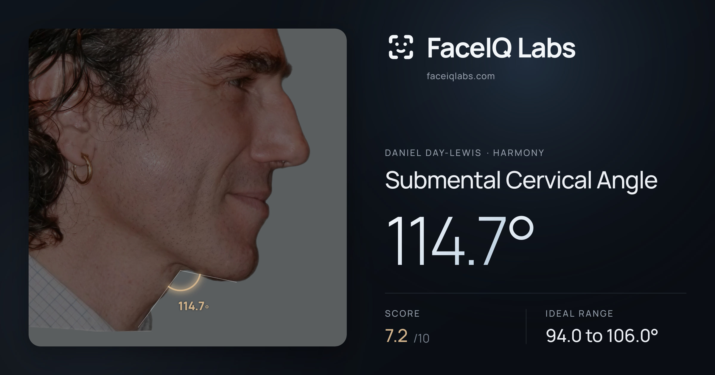 Daniel Day-Lewis Submental Cervical Angle: 114.7°, drawn on the photo