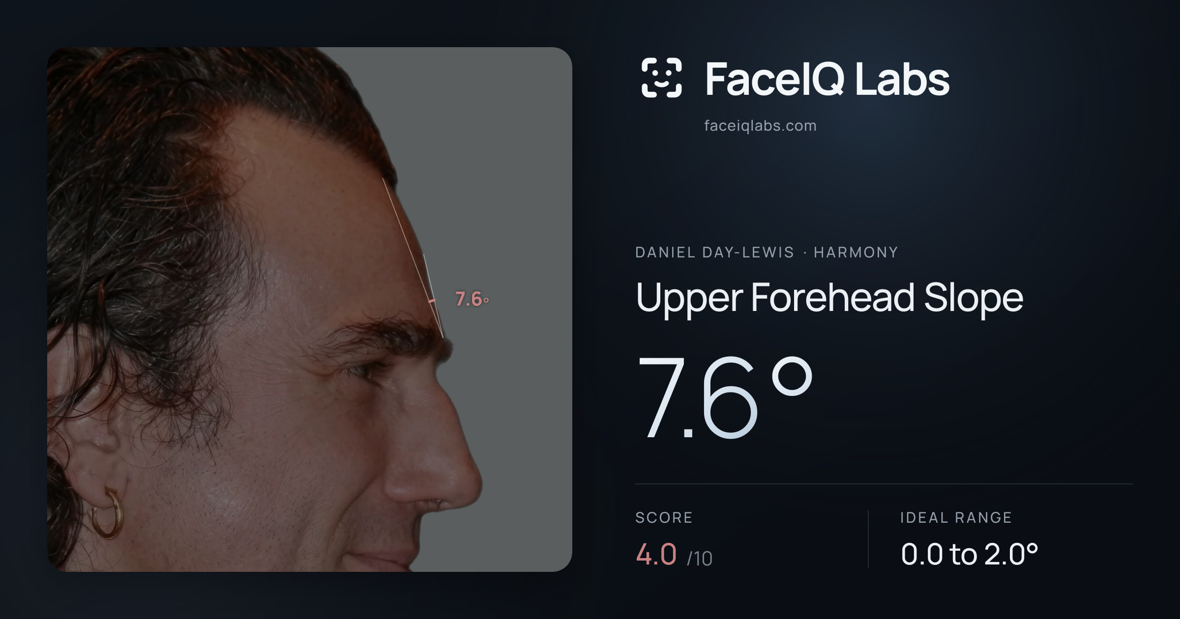 Daniel Day-Lewis Upper Forehead Slope: 7.6°, drawn on the photo