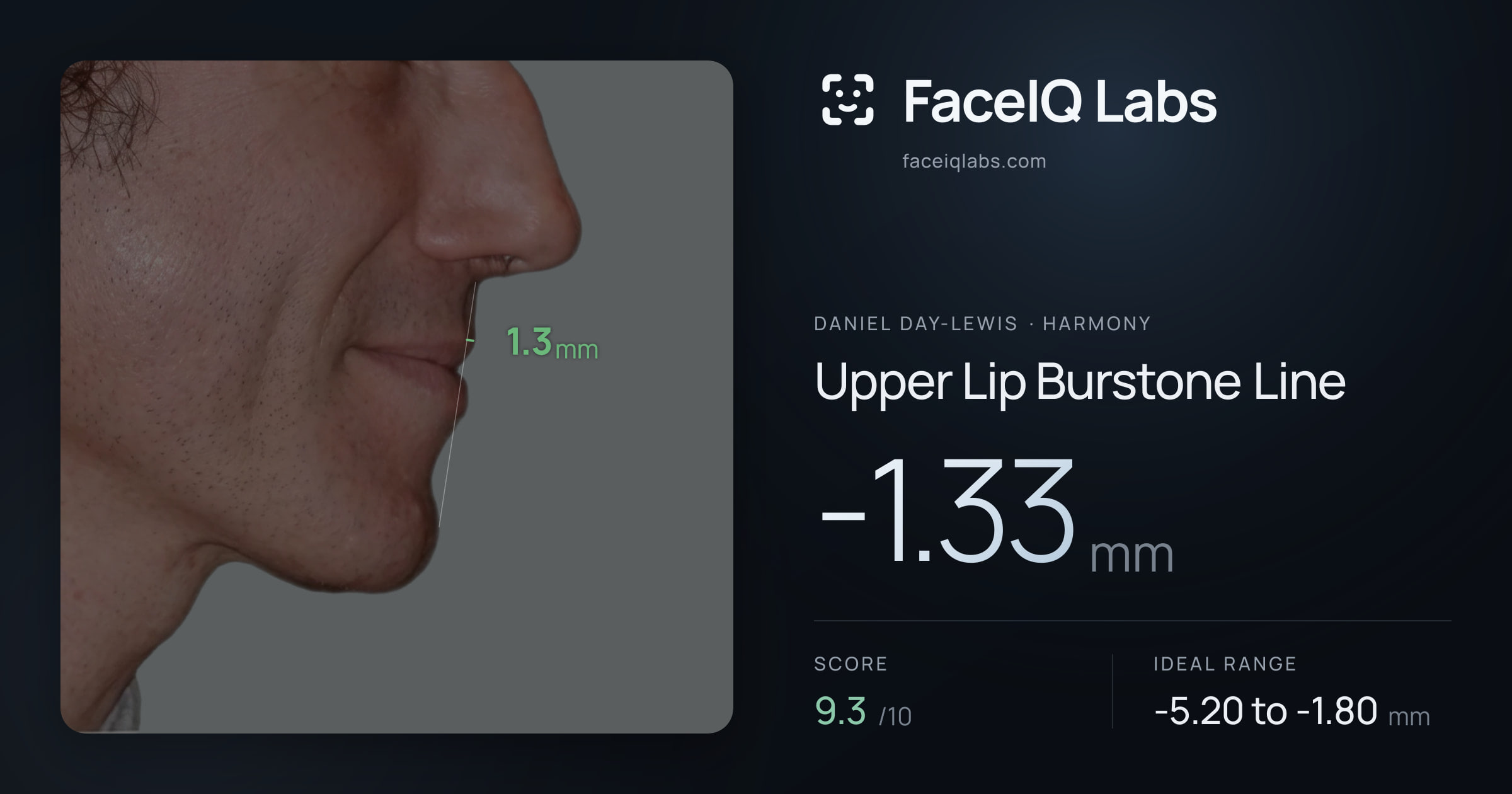 Daniel Day-Lewis Upper Lip Burstone Line: -1.33mm, drawn on the photo