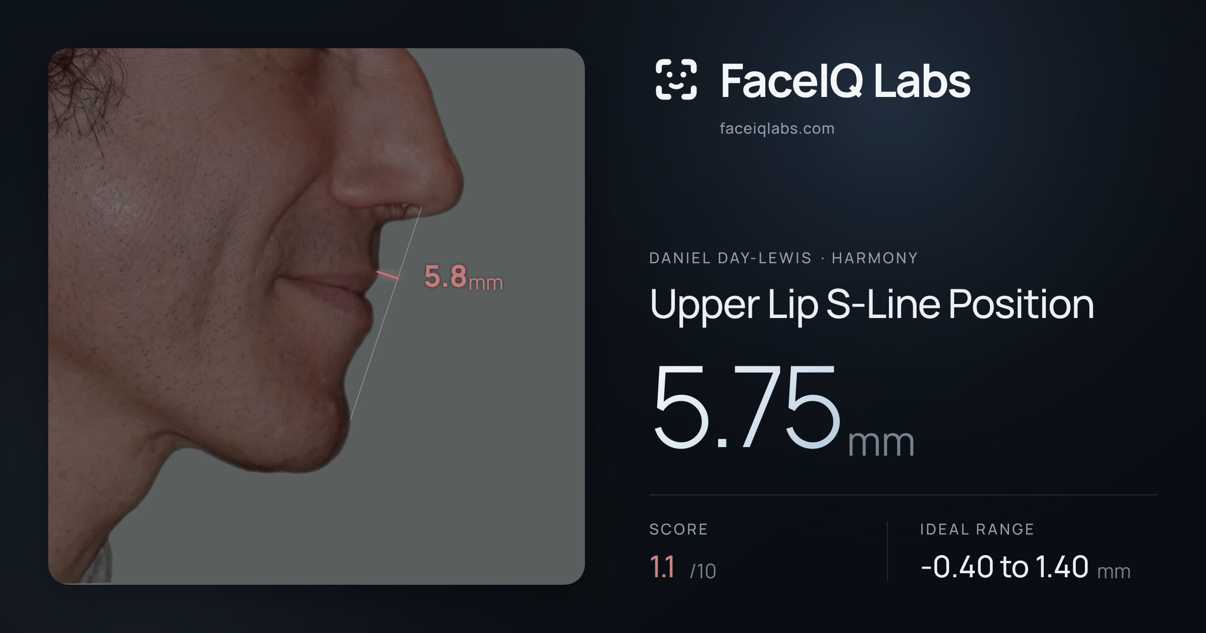 Daniel Day-Lewis Upper Lip S-Line Position: 5.75mm, drawn on the photo