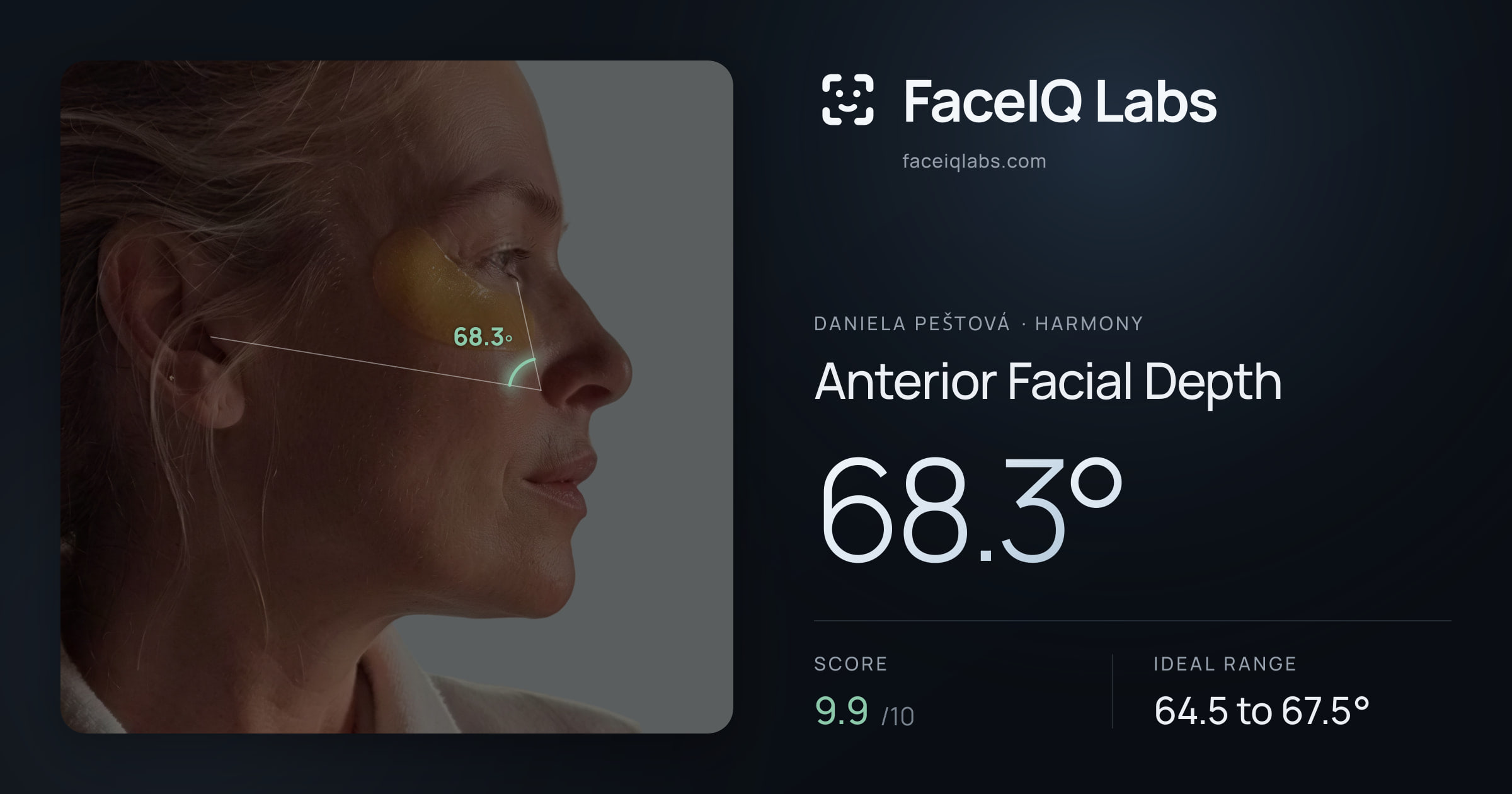 Daniela Peštová Anterior Facial Depth: 68.3°, drawn on the photo